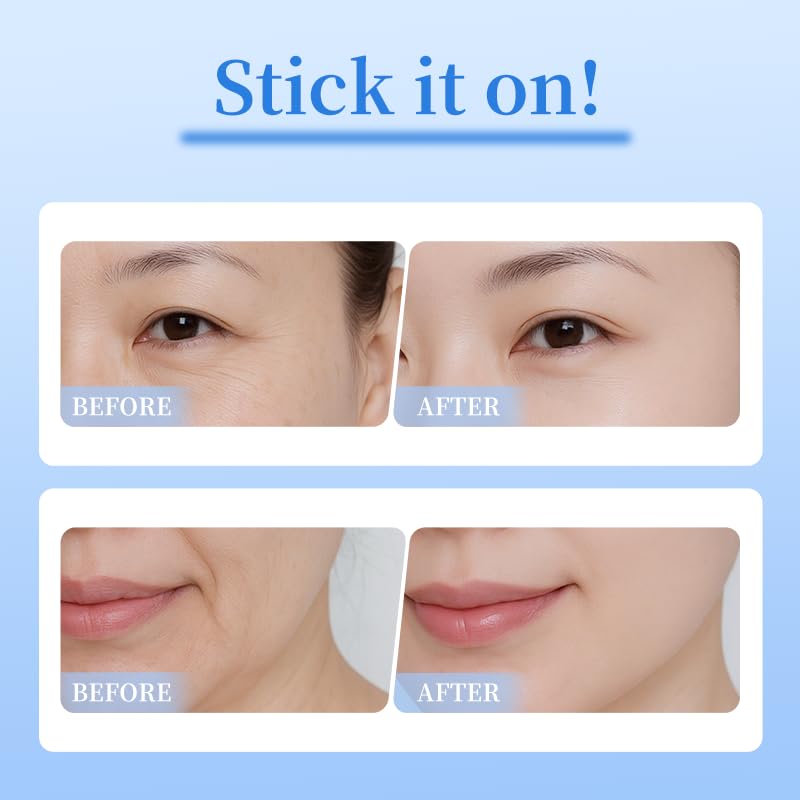 Natener 4 Pairs PDRN Micro Eye Patches | Hyaluronic Acid, Kojic Acid, Collagen + Peptides