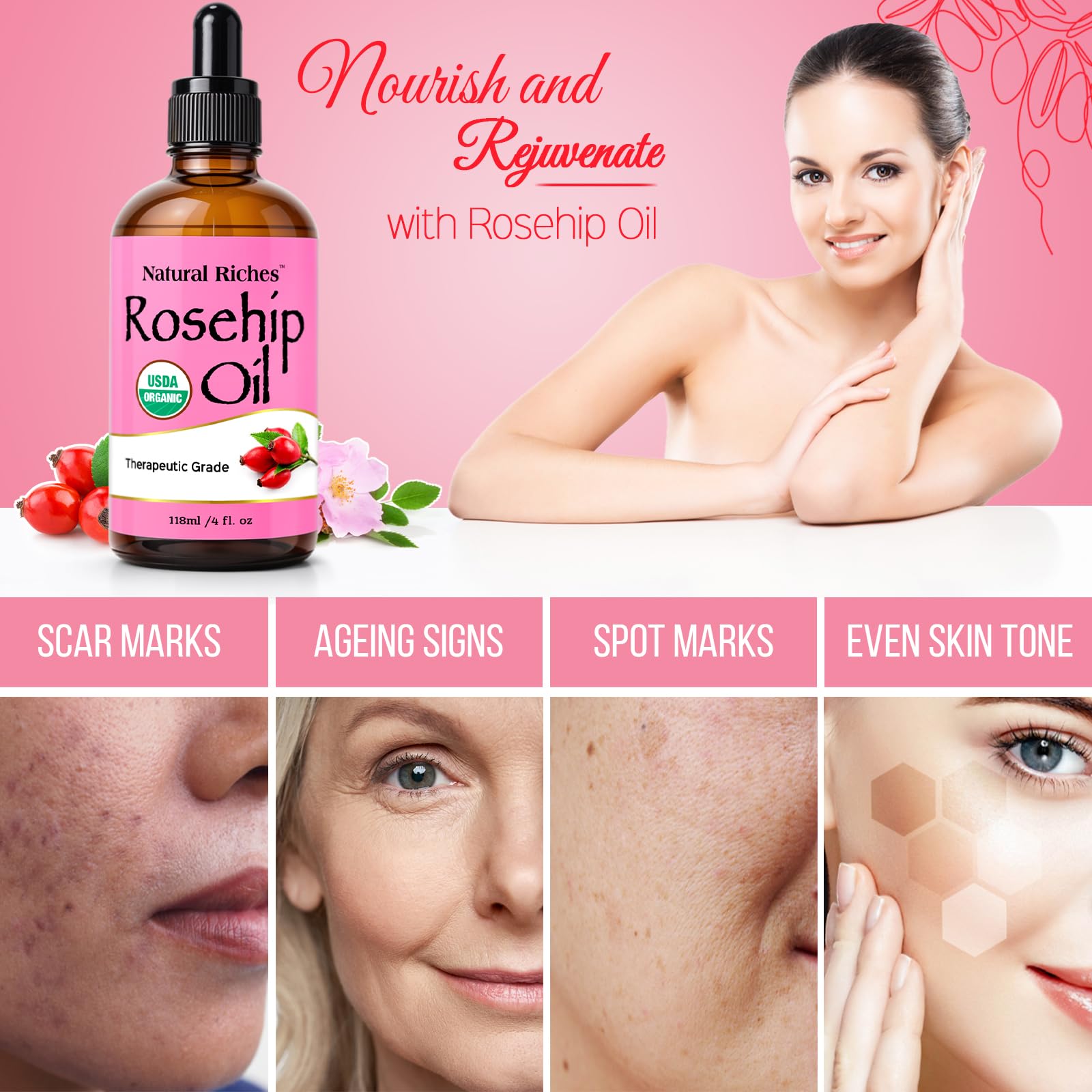 Natural Riches Organic Rosehip Seed Oil – 100% Pure, Cold-Pressed, 4 oz