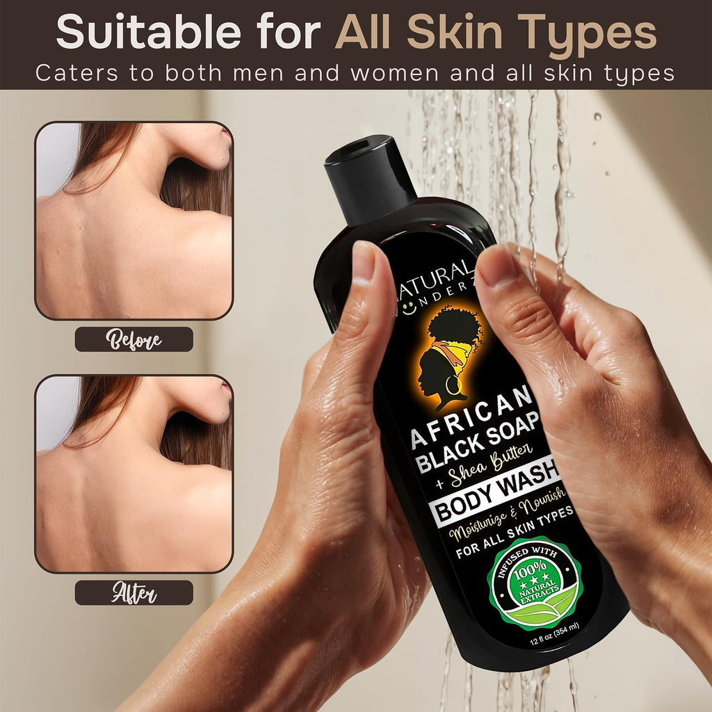 Natural Wunderz African Black Soap Body Wash 12 oz – Sulfate-Free Vegan Cleanser with Shea Butter