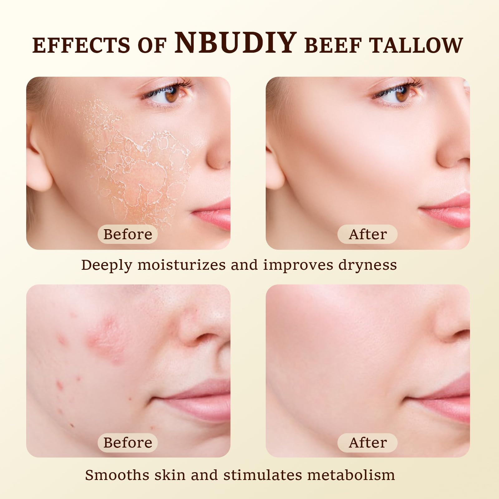 NBUDIY Beef Tallow Face Moisturizer | Fragrance-Free, Grass-Fed Tallow & Honey Balm, 4.23 oz
