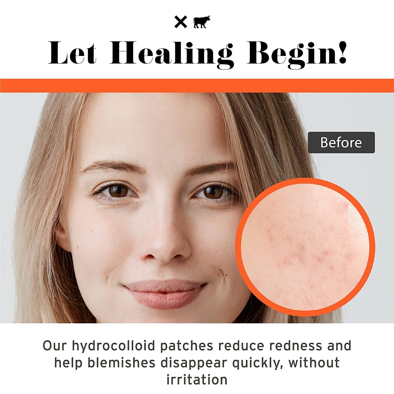 No Bad Stuff - All Day & Overnight Acne Patch Duo (144 ct)
