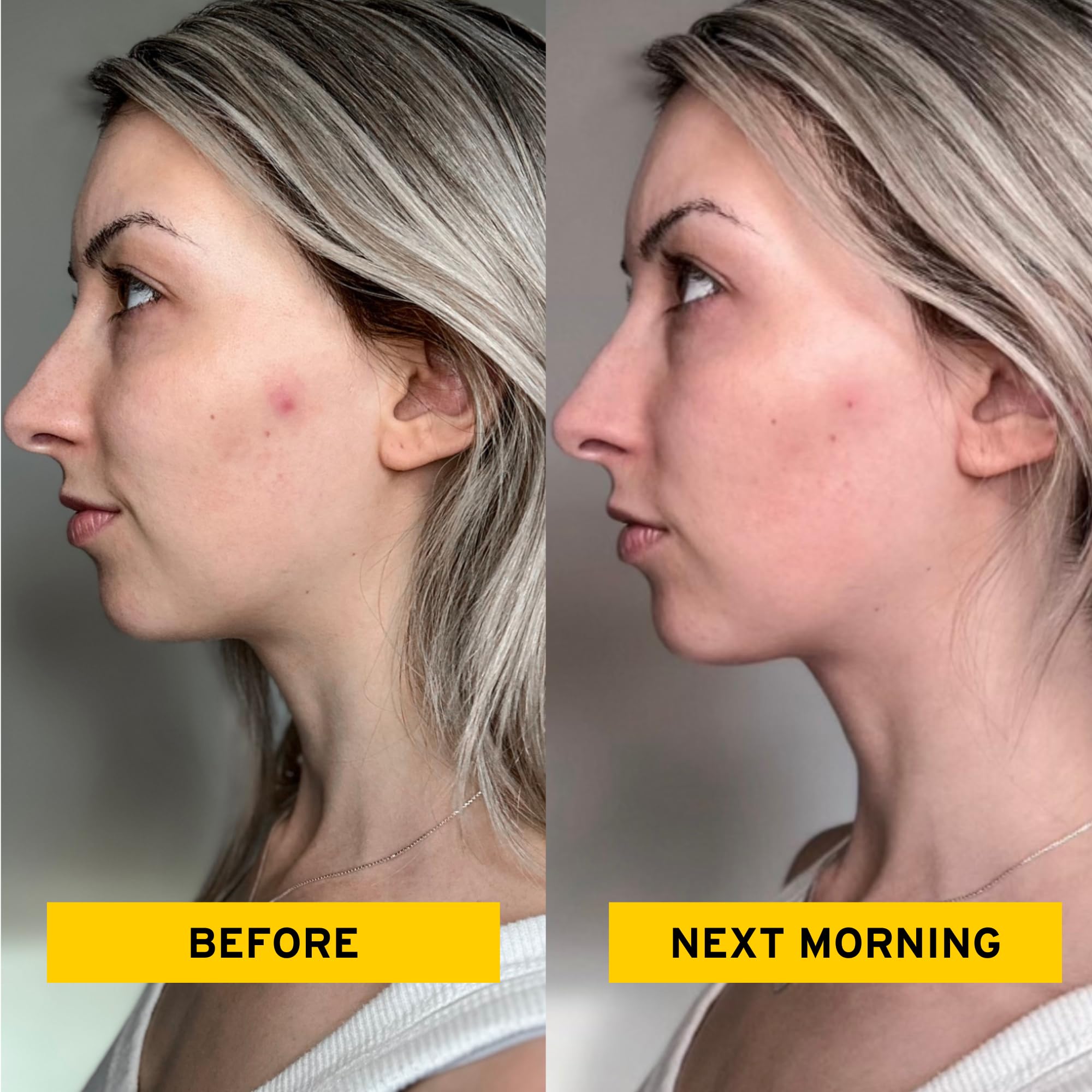 No Bad Stuff - All Day & Overnight Acne Patch Duo (144 ct)