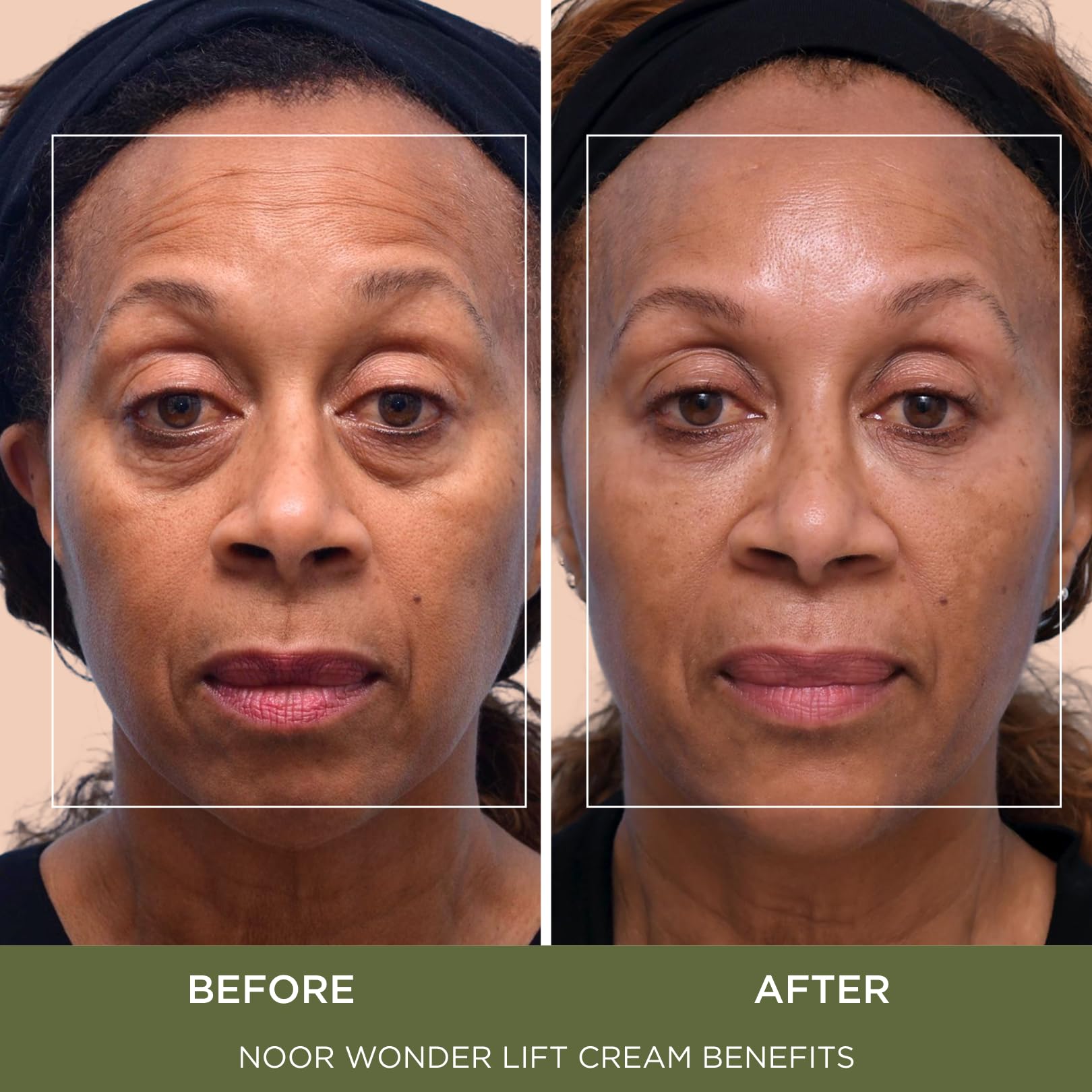 Noor Wonder Lift Cream for Women – Natural Anti-Aging Moisturizer | NOOR HAIR