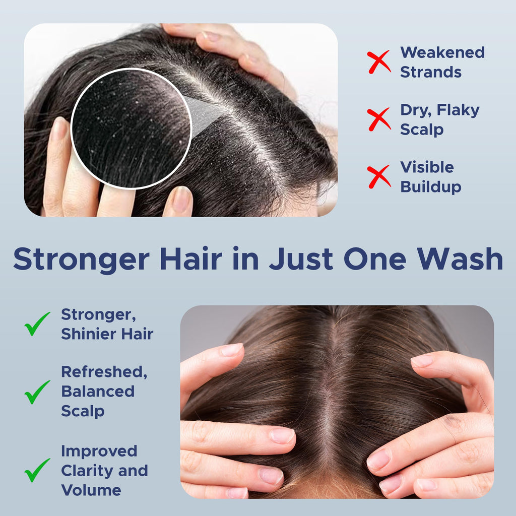 Nora Ross Garlic Extract Hair Strengthening Shampoo – Thickening, Rosemary, 32oz