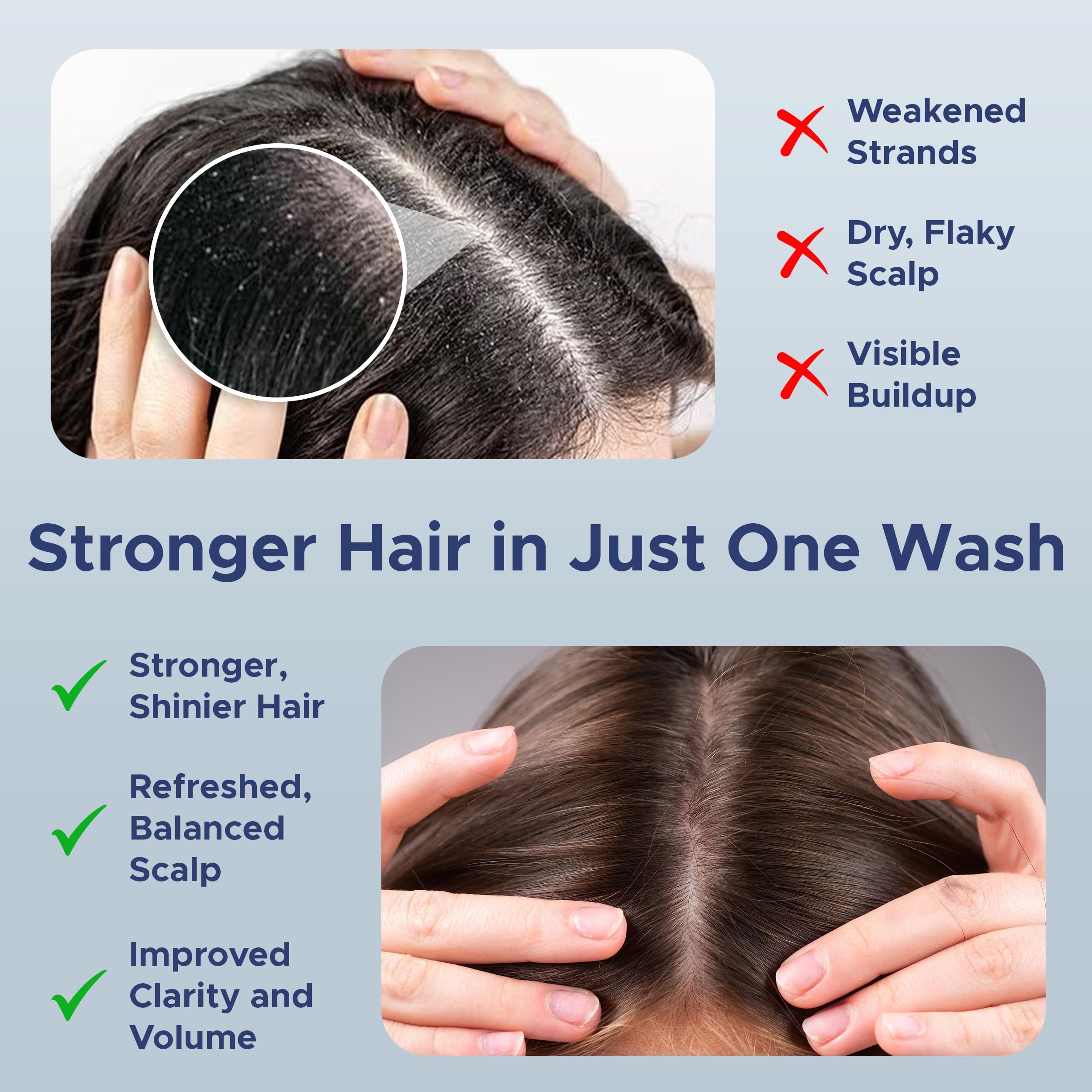 Nora Ross Garlic Extract Hair Strengthening Shampoo – Thickening, Rosemary, 32oz