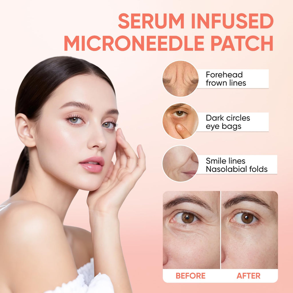 NOVALIFT Micro Eye Patches – Hydrating Under-Eye Patches for Puffy Eyes & Fine Lines (3 Pairs)