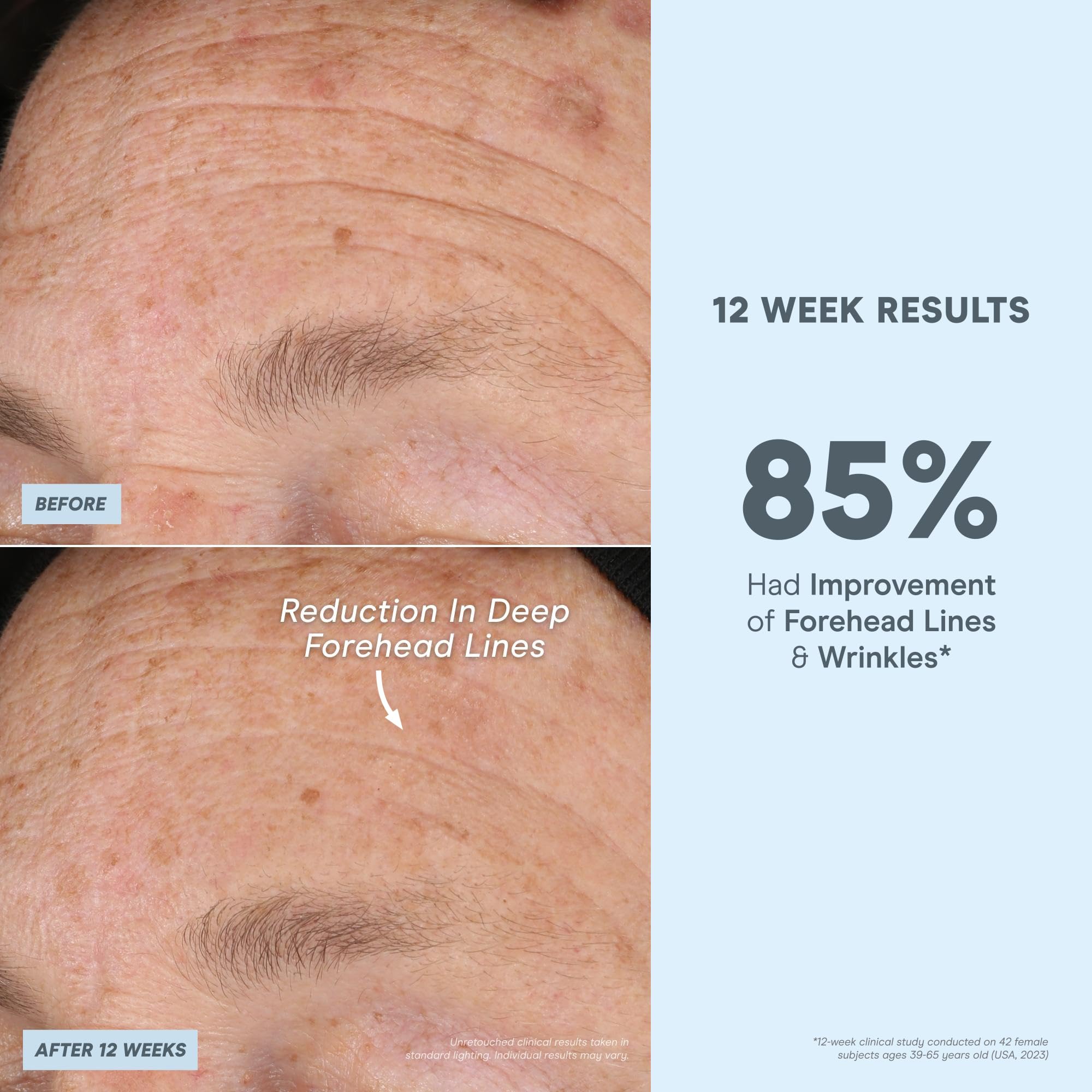 NuFACE Super Peptide Booster Face Serum | Firming, Hydration & IonPlex Prep for Microcurrent