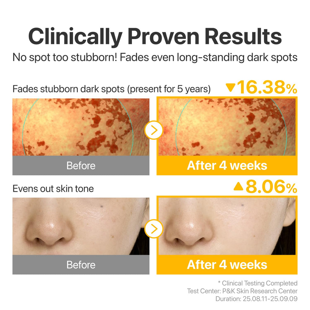 numbuzin No.5 Glutathione TXA Dark Spot Ampoule – Targeted Tone Care for Uneven Skin