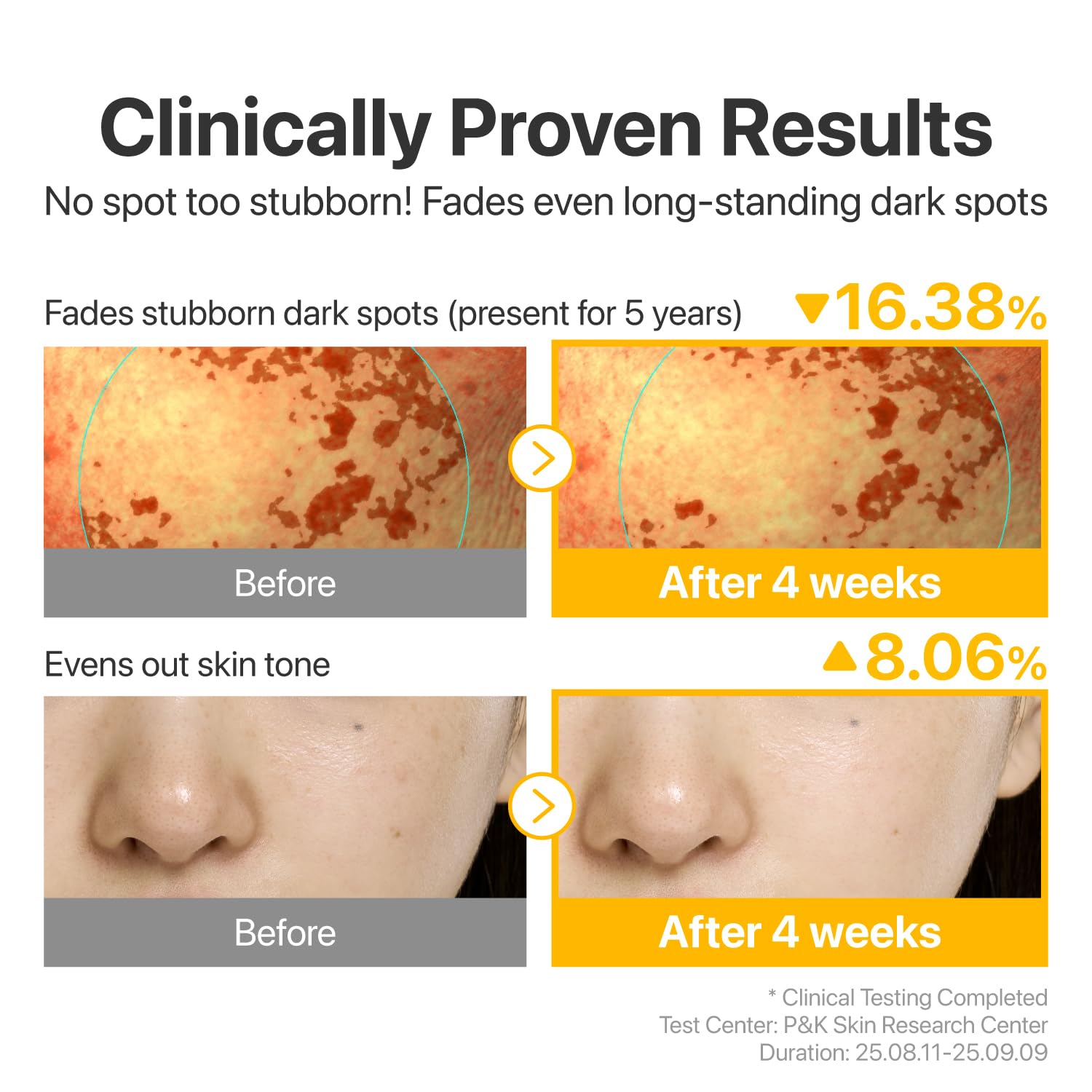 numbuzin No.5 Glutathione TXA Dark Spot Ampoule – Targeted Tone Care for Uneven Skin
