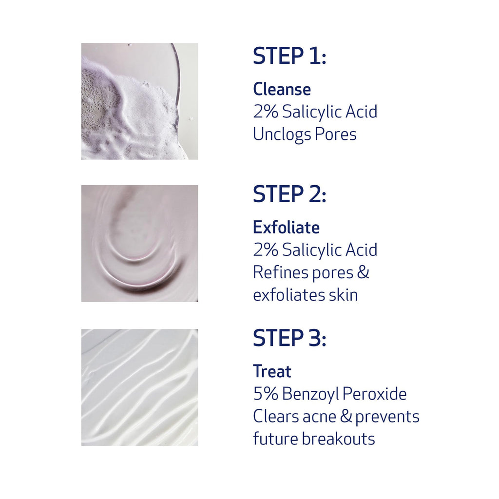 Obagi CLENZIderm M.D. Therapeutic System – 3 Step Acne Treatment with 2% BHA Cleanser, 2% BHA Toner, 5% BPO