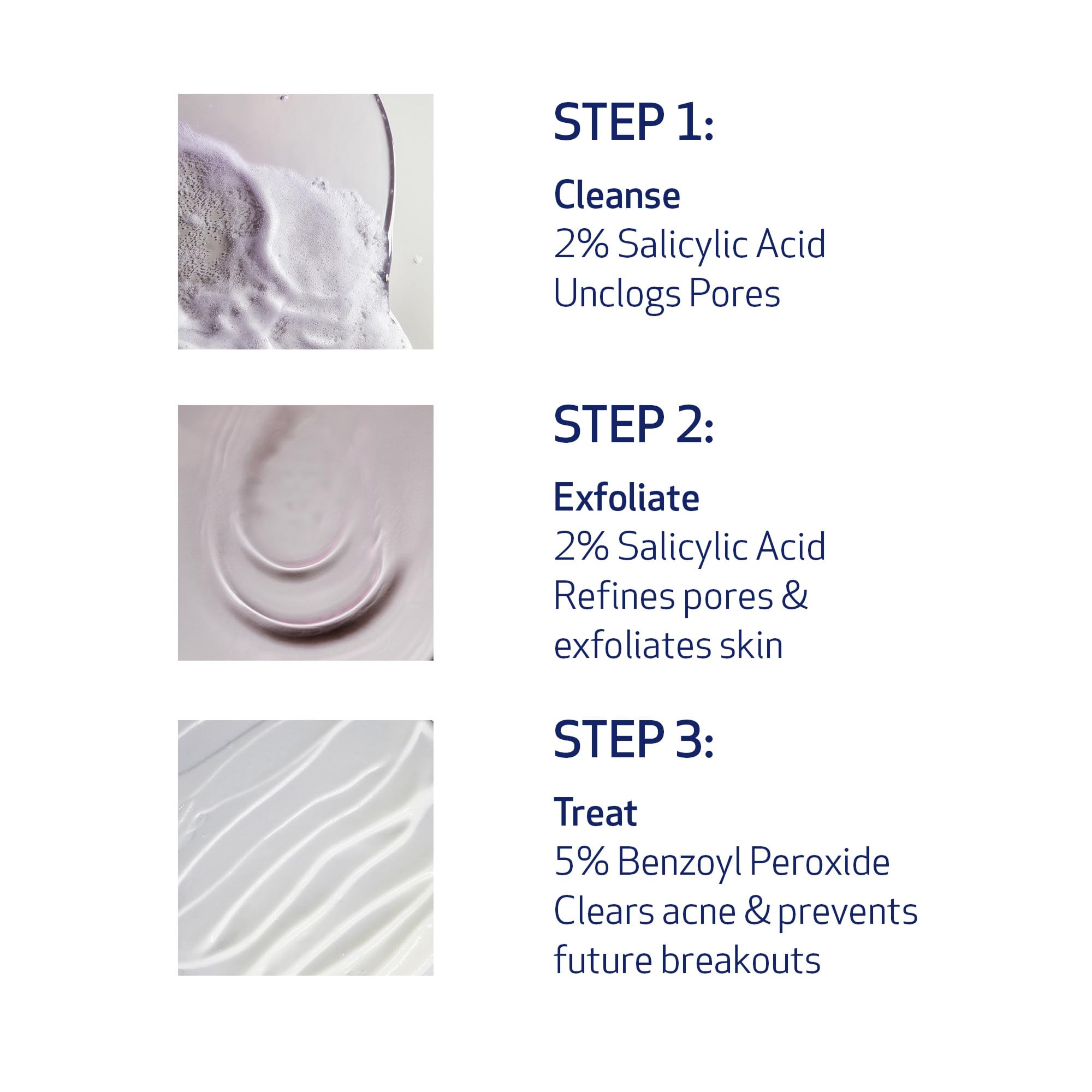 Obagi CLENZIderm M.D. Therapeutic System – 3 Step Acne Treatment with 2% BHA Cleanser, 2% BHA Toner, 5% BPO