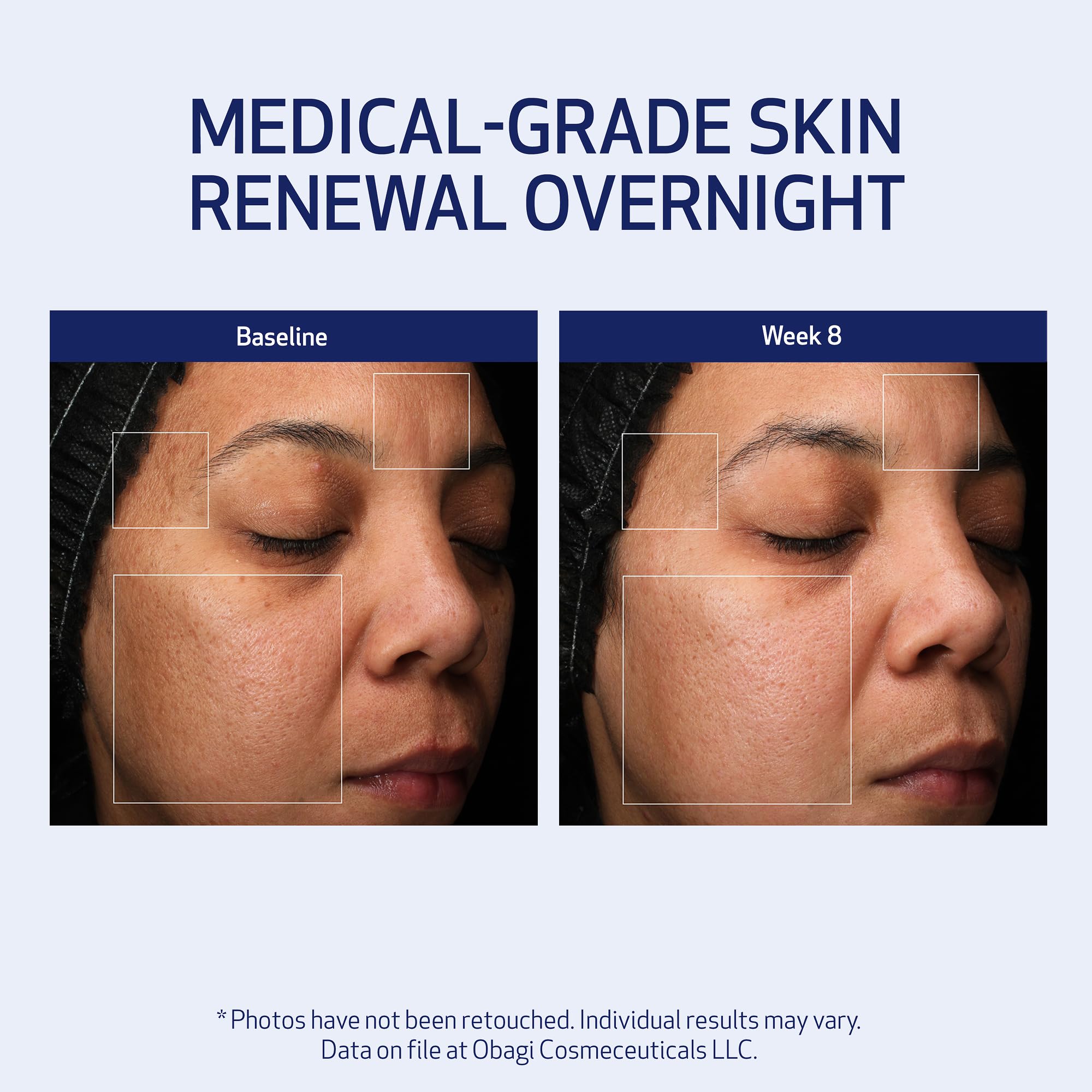 Obagi Medical Retinol + PHA Refining Night Cream – Overnight Anti-Aging, Smoother Skin & Even Complexion | 1.7 oz