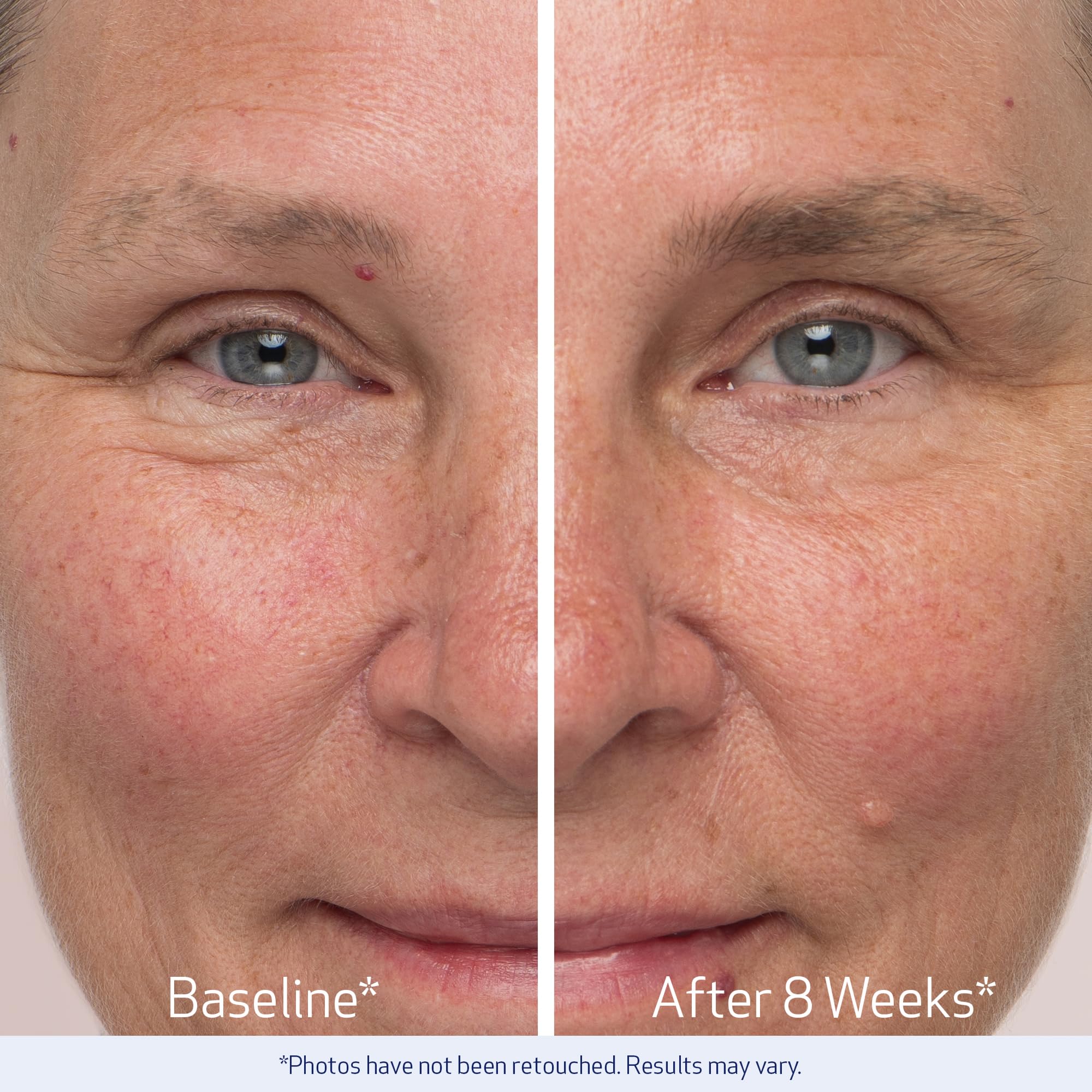 Obagi Nu-Cil Eyebrow Boosting Serum – Pack of 2 | Fuller Brows Over Time