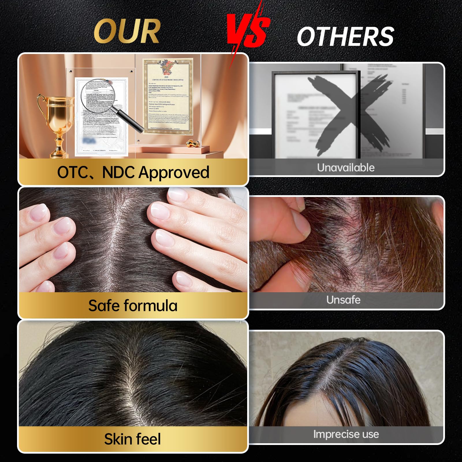 OCSINL 5% Minoxidil for Hair Regrowth — Biotin, Rosemary & Batana Oil (3-Pack)