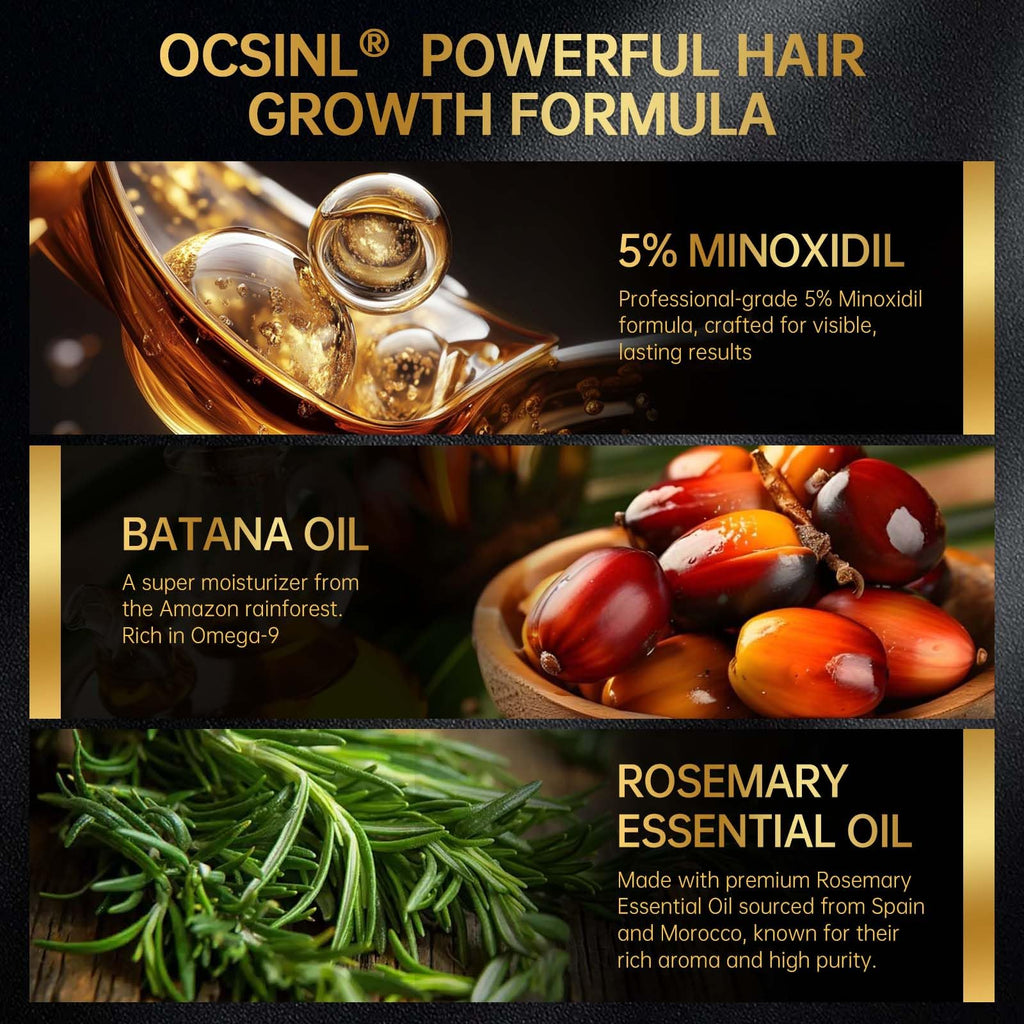 OCSINL Minoxidil 5% Serum + Massager Set for Men & Women – Hair Regrowth Solution with Biotin, Rosemary & Batana Oil (60ml)