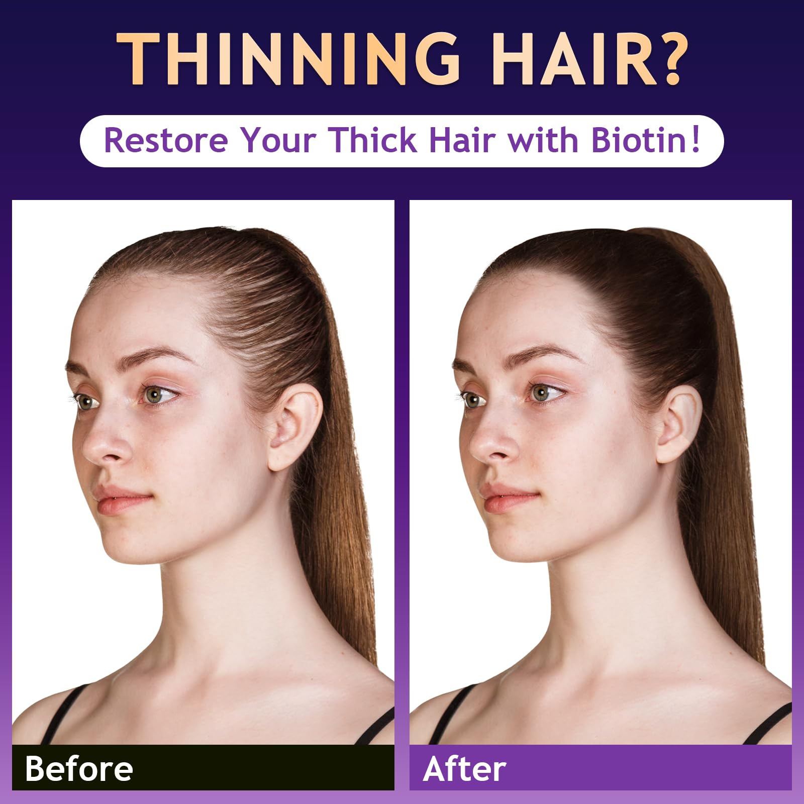 Oely Biotin Hair Growth & Thickening Shampoo – Root Activator, Sulfate-Free