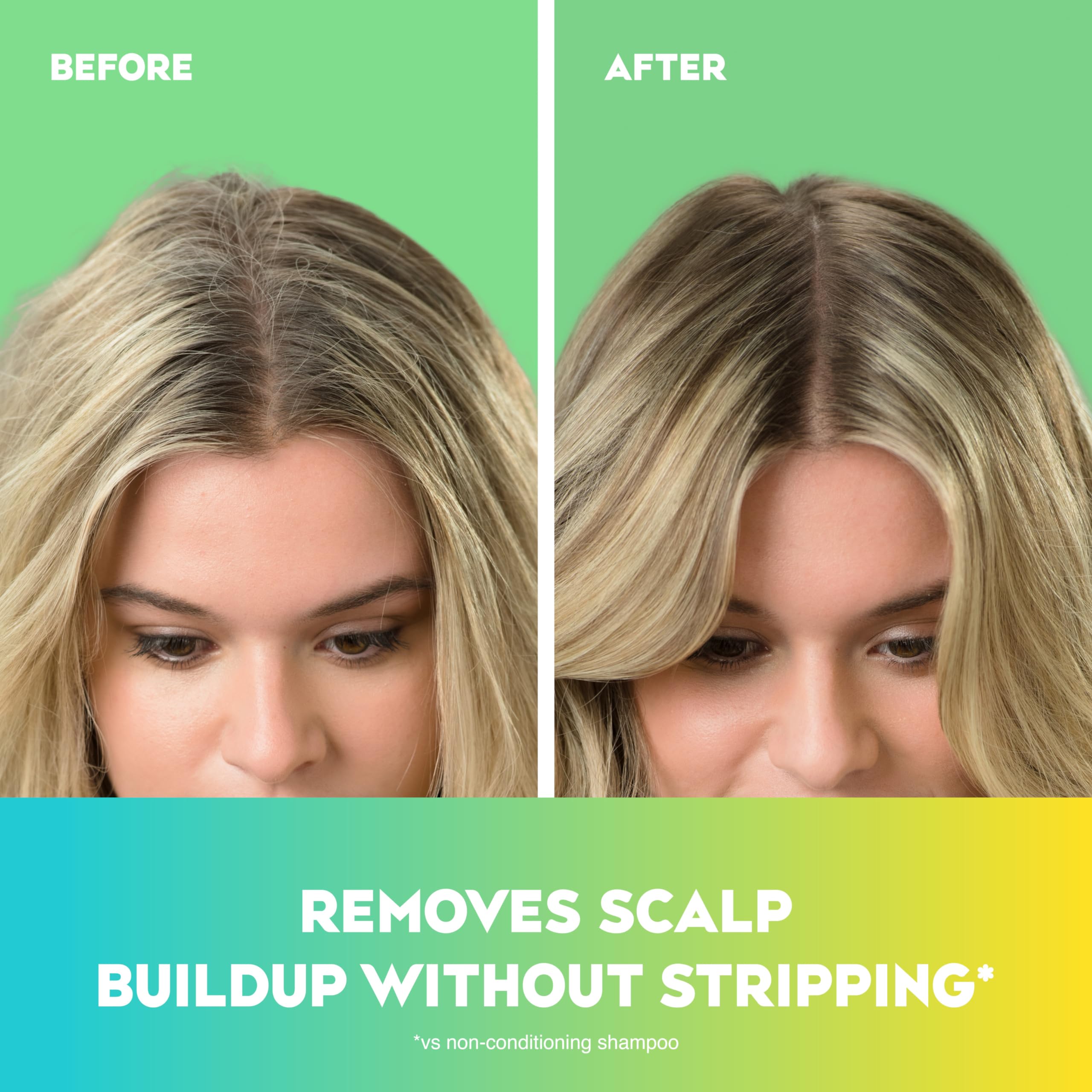 OGX Extra Strength Refreshing Scalp + Teatree Mint Shampoo – Invigorating, Sulfate- & Paraben-Free