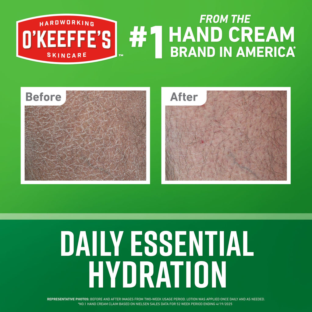 O'Keeffe's Hand & Body Lotion 12 oz Pump – Daily Hydration & Dry Skin Relief