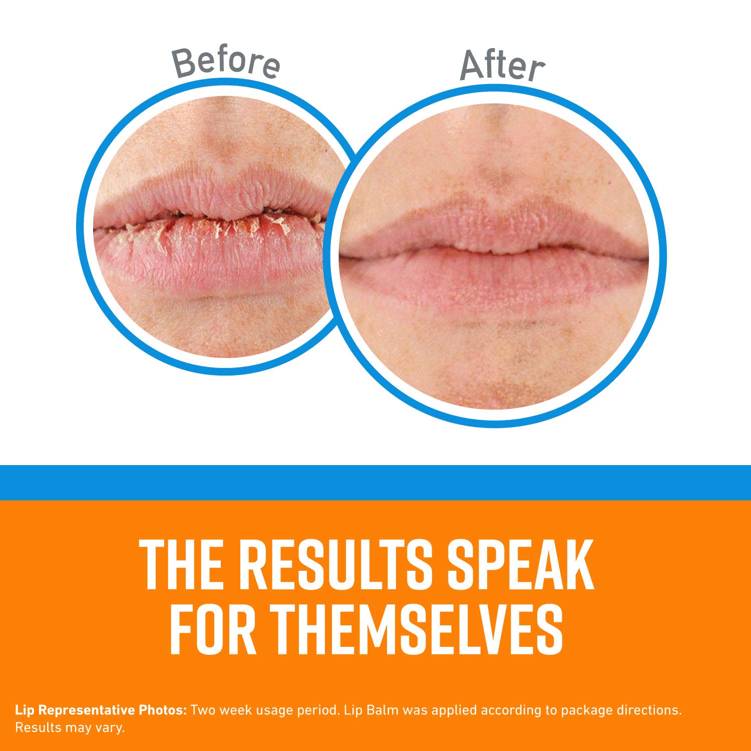 O'Keeffe's Cooling Relief Lip Repair Lip Balm Stick – Pack of 10
