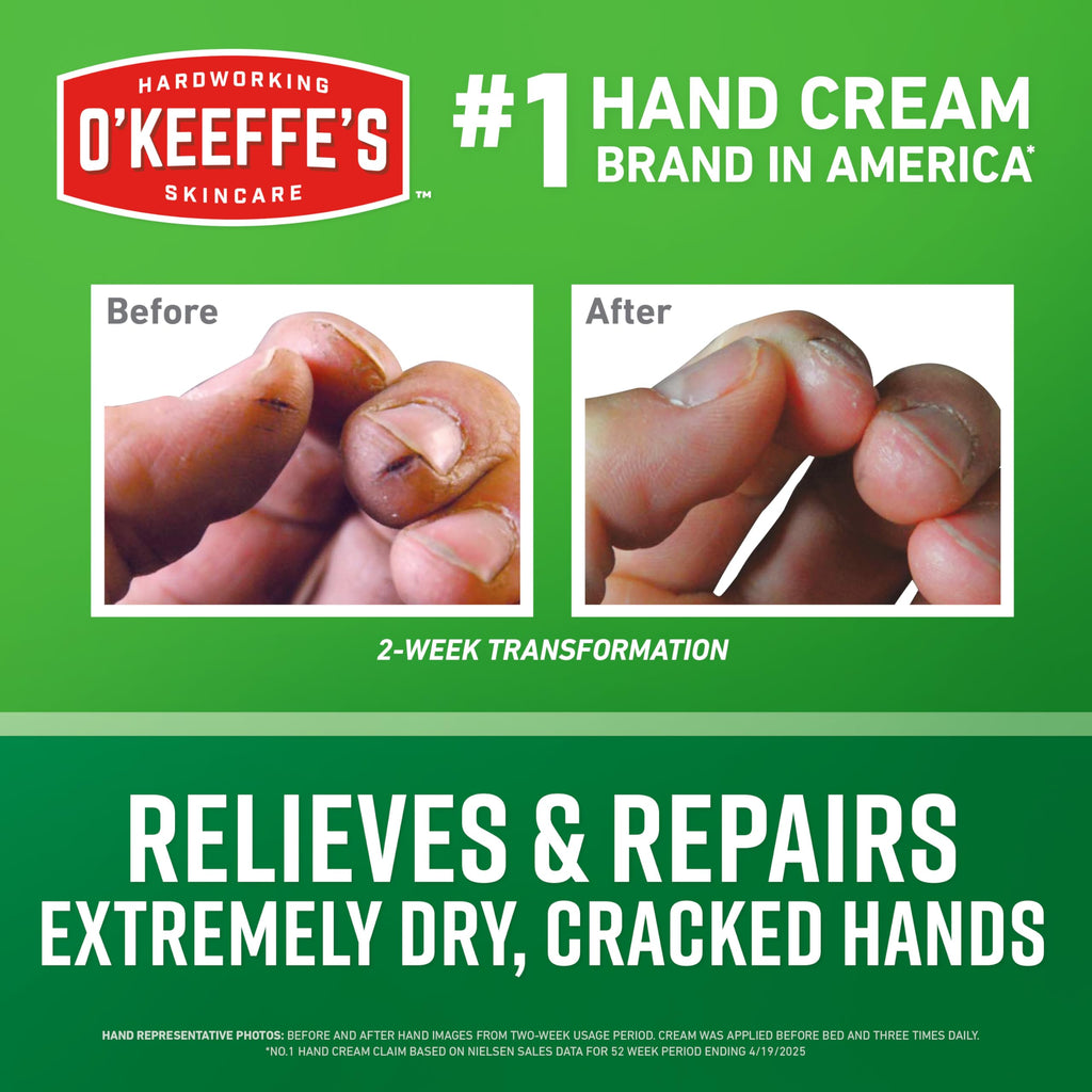 O'Keeffe's Working Hands Hand Cream – 3.4 oz Jar (2-Pack) for Extreme Dryness