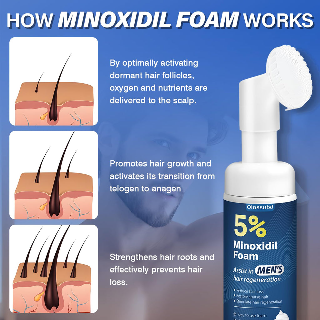 Olassubd Minoxidil 5% Foam for Men – Hair Growth Solution