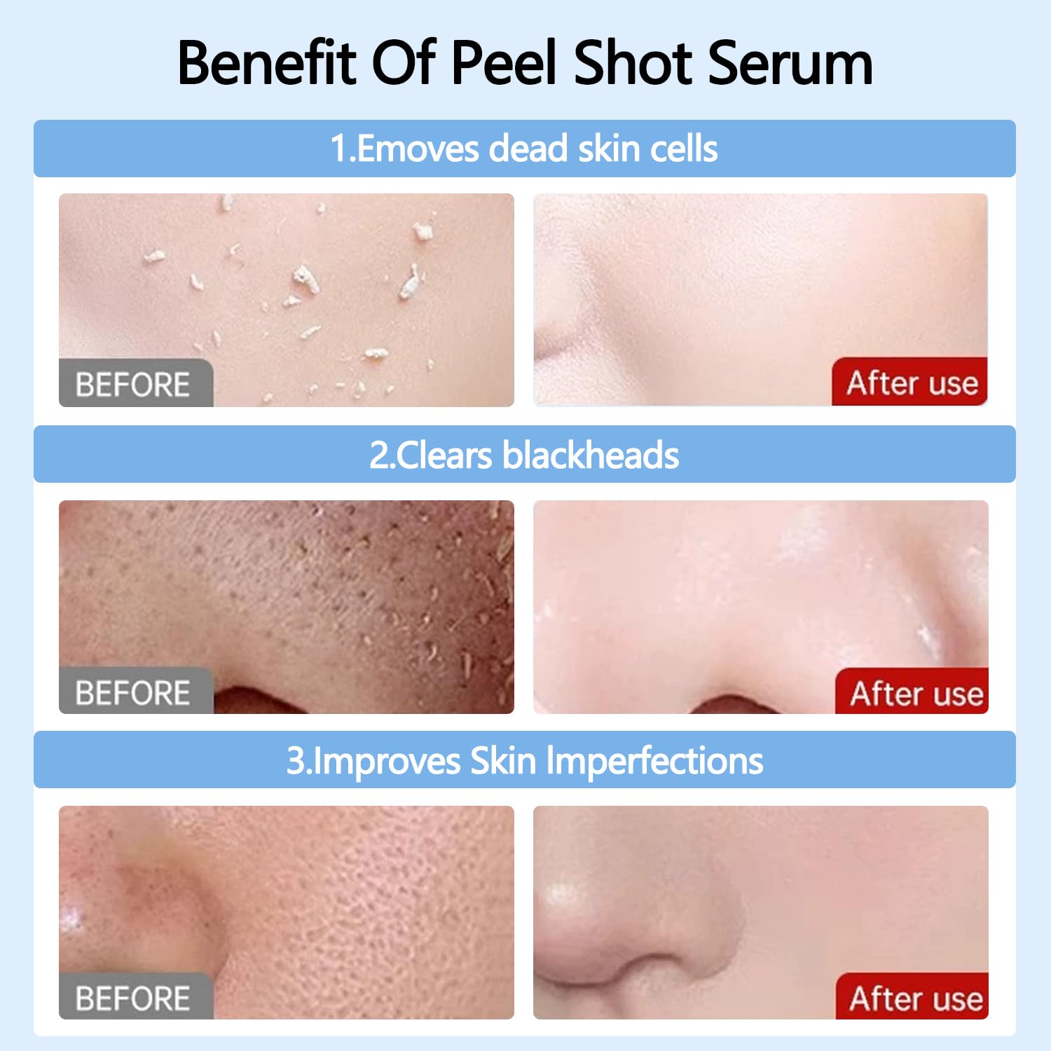 OLV Peel Shot Glow Rice Ampoule Duo – White & Black Rice Exfoliant for All Skin Types