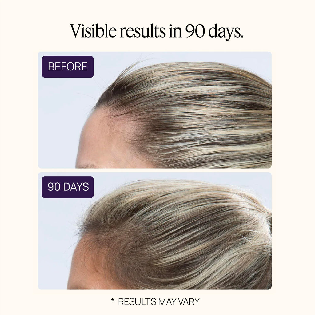 OMI WellBeauty Womens Hair Growth Peptides — Doctor-Recommended Follicle Fortifying Biotechnology