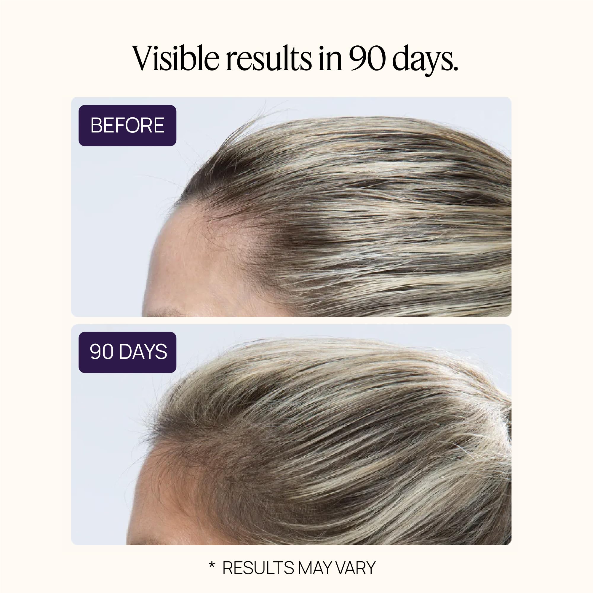 OMI WellBeauty Womens Hair Growth Peptides — Doctor-Recommended Follicle Fortifying Biotechnology