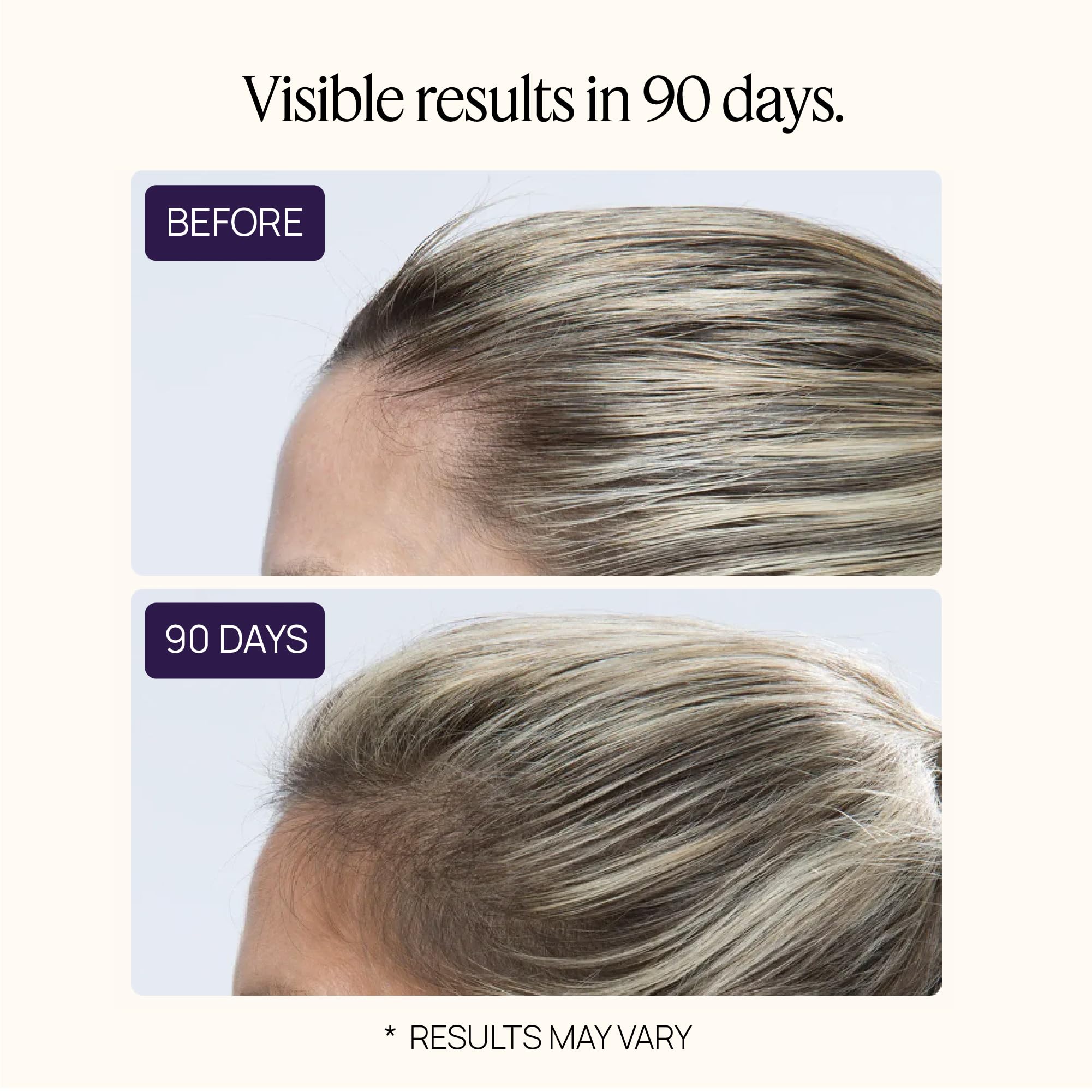 OMI WELLBEAUTY Hair Growth Peptides Gummies – Doctor-Recommended Patented Biotech, 180 Count
