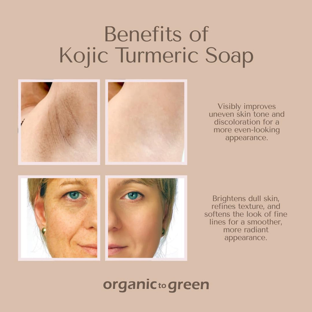Organic To Green Kojic Turmeric Soap for Dark Spots – 3 Pack (Lemon, Fresh Ginger, Lavender) with Hyaluronic Acid & Retinol