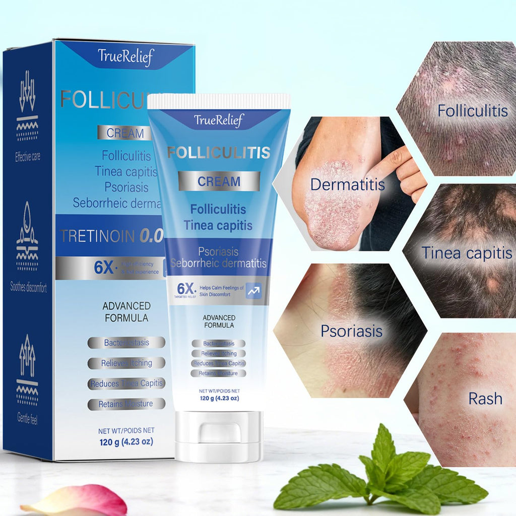 OUHENGTEK Folliculitis Cream | Soothes Bumps on Scalp, Face & Body – 120g (01)