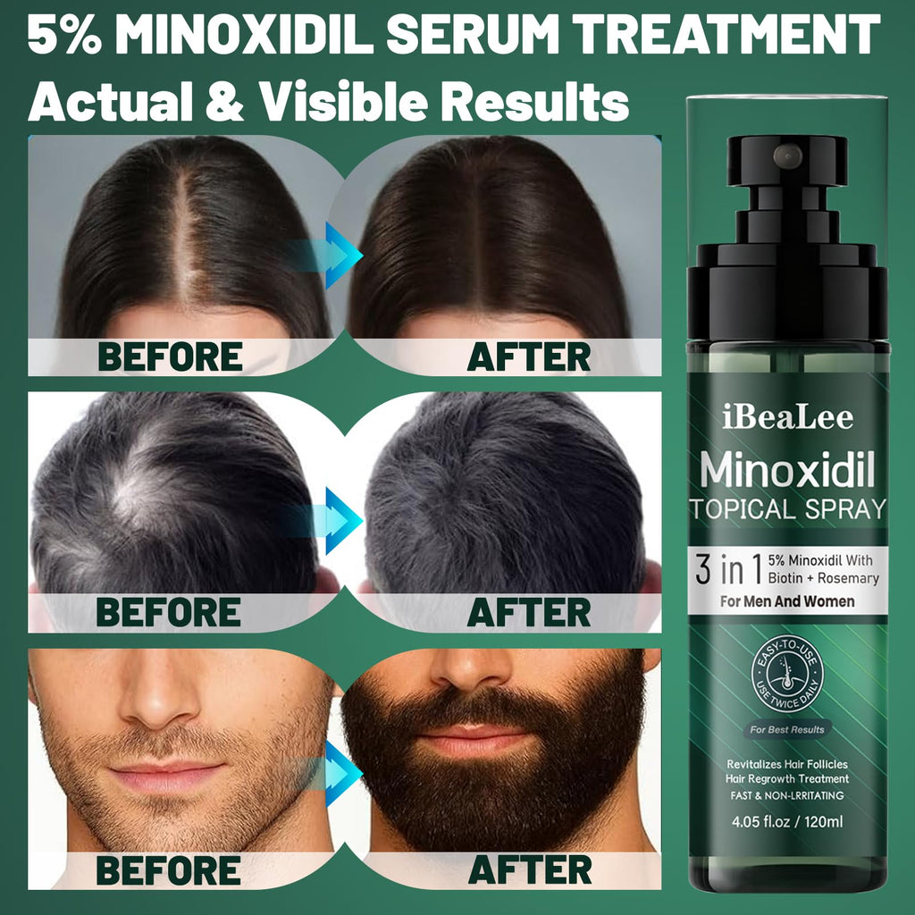 OURMUST 5% Minoxidil Hair Growth Spray for Men & Women – Biotin & Rosemary, 2 Bottles