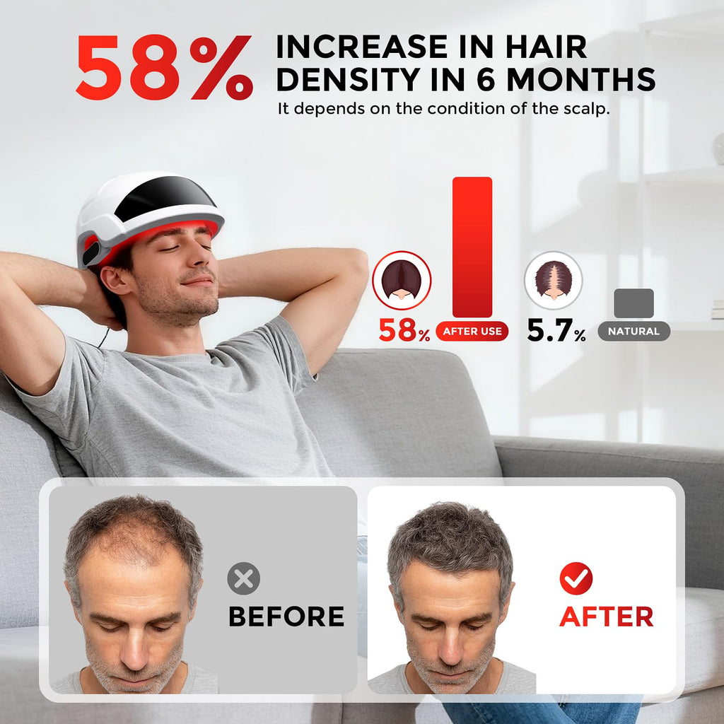 OVEKPA Red Light Therapy Hair Growth Laser Cap | FDA Cleared for At-Home Hair Regrowth