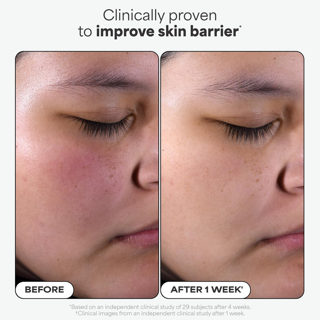 Paula's Choice Skin Perfecting 2% BHA Liquid Exfoliant Pads (10 ct) – Travel-Friendly