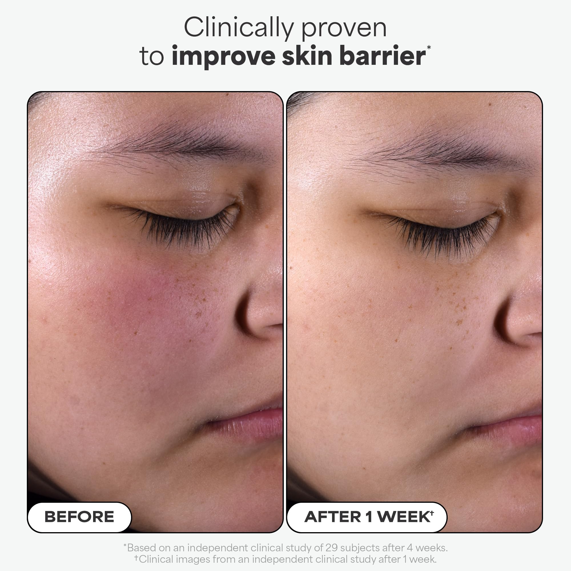 Paula's Choice Skin Perfecting 2% BHA Liquid Exfoliant Pads (10 ct) – Travel-Friendly