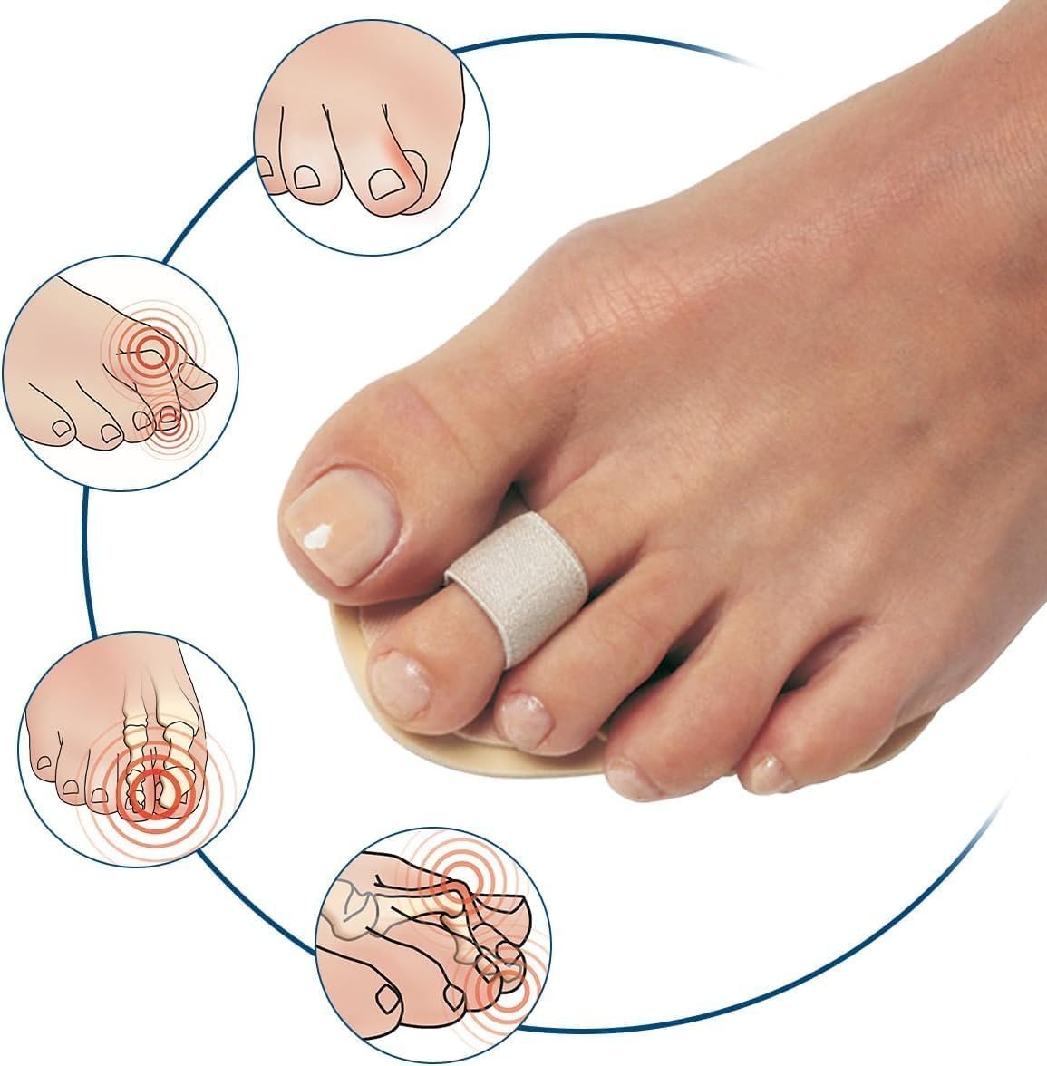 Pedifix Toe Straightener – Gentle Toe Alignment for Hammer Toes & Crooked Toes | One Size Fits Most | Bulk Pack of 12