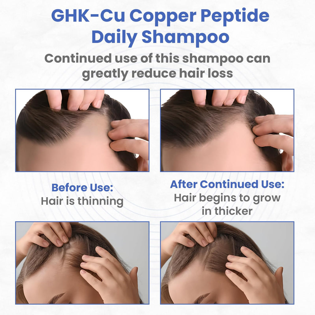PeptideLabz Copper Peptide Shampoo – Anti Hair Loss & Growth Support