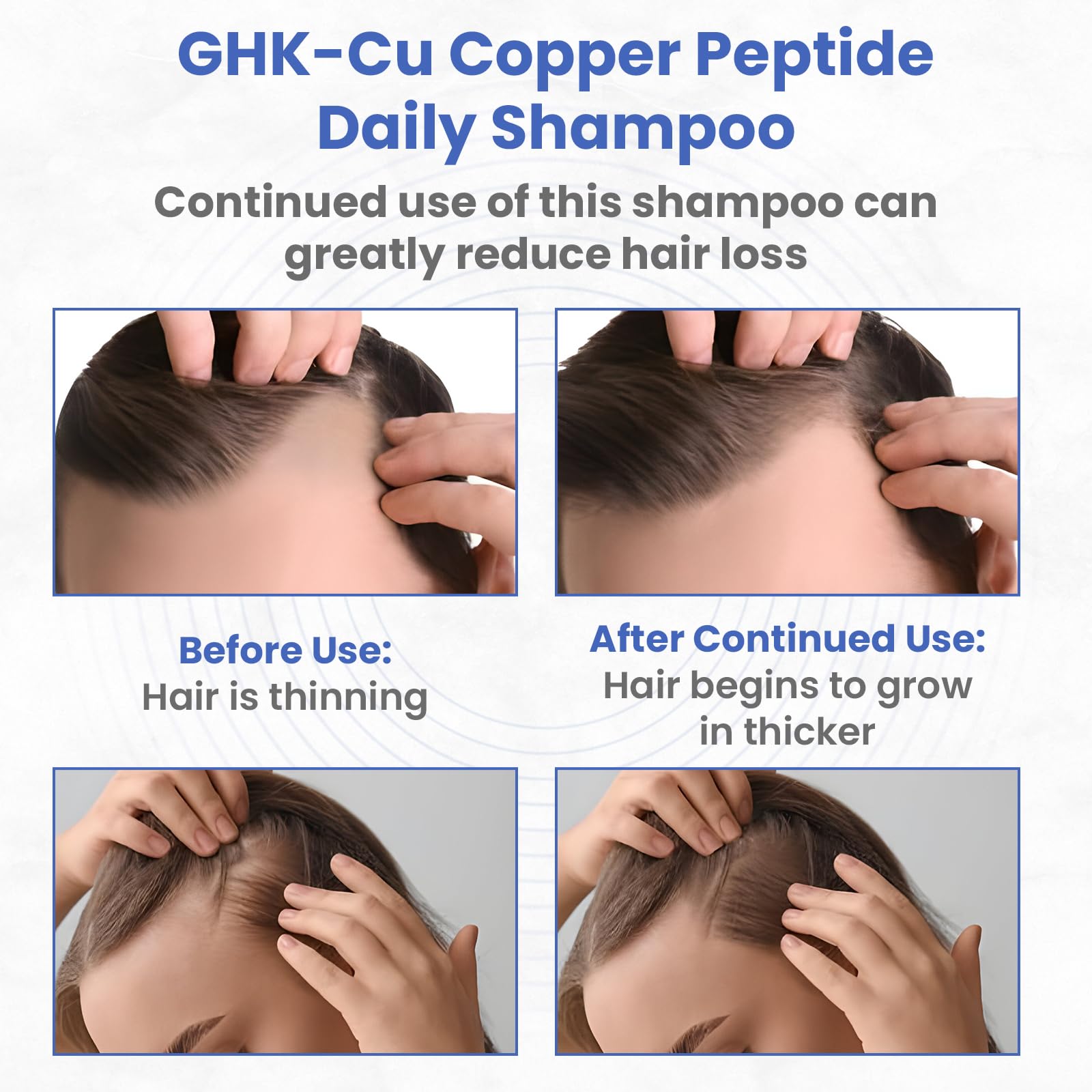 PeptideLabz Copper Peptide Shampoo – Anti Hair Loss & Growth Support