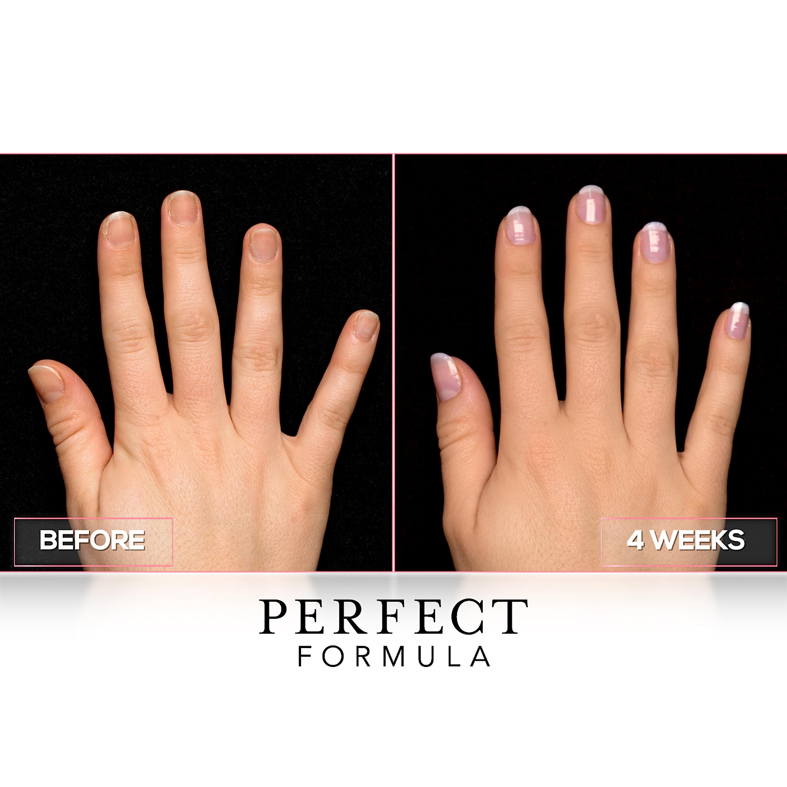 Perfect Formula Clear Gel Coat - Nail Strengthener, Keratin Treatment, 0.60 fl oz - Made in USA