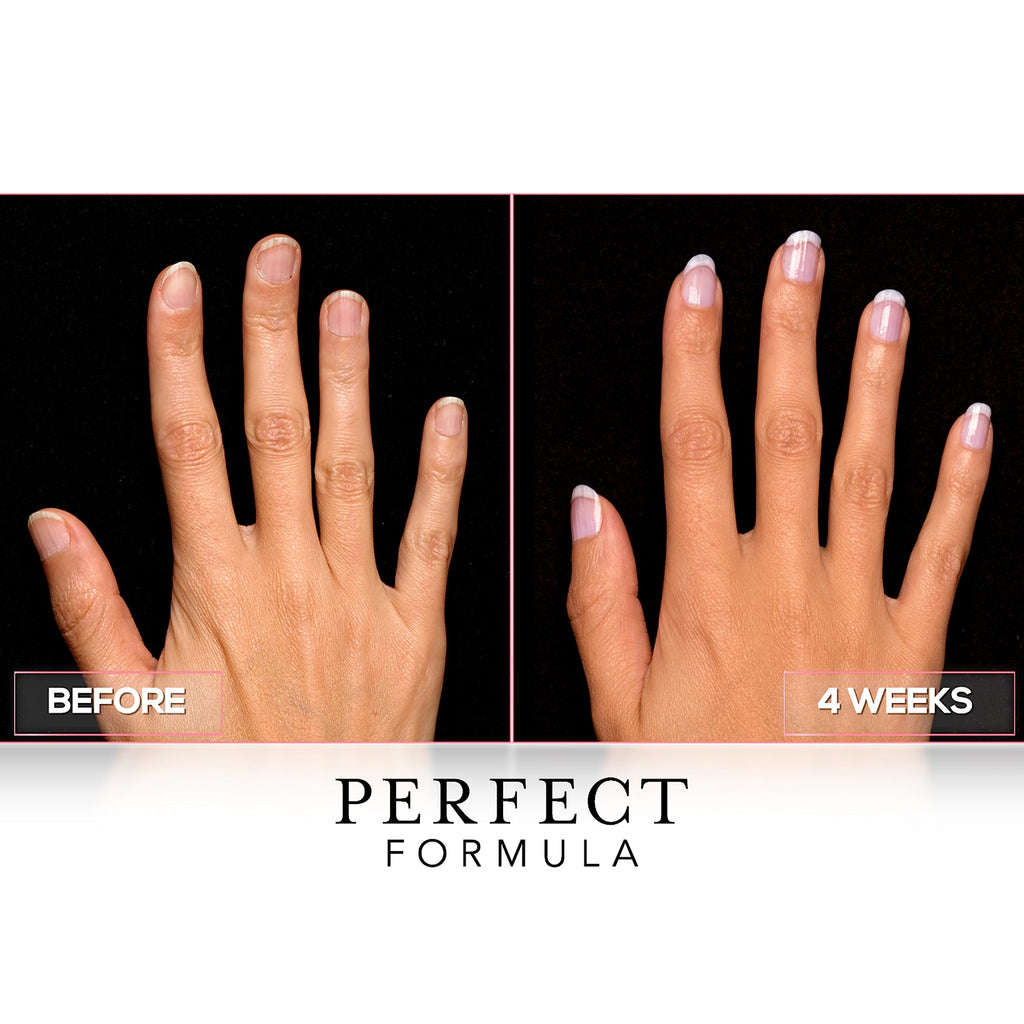 Perfect Formula Clear Gel Coat - Nail Strengthener, Keratin Treatment, 0.60 fl oz - Made in USA