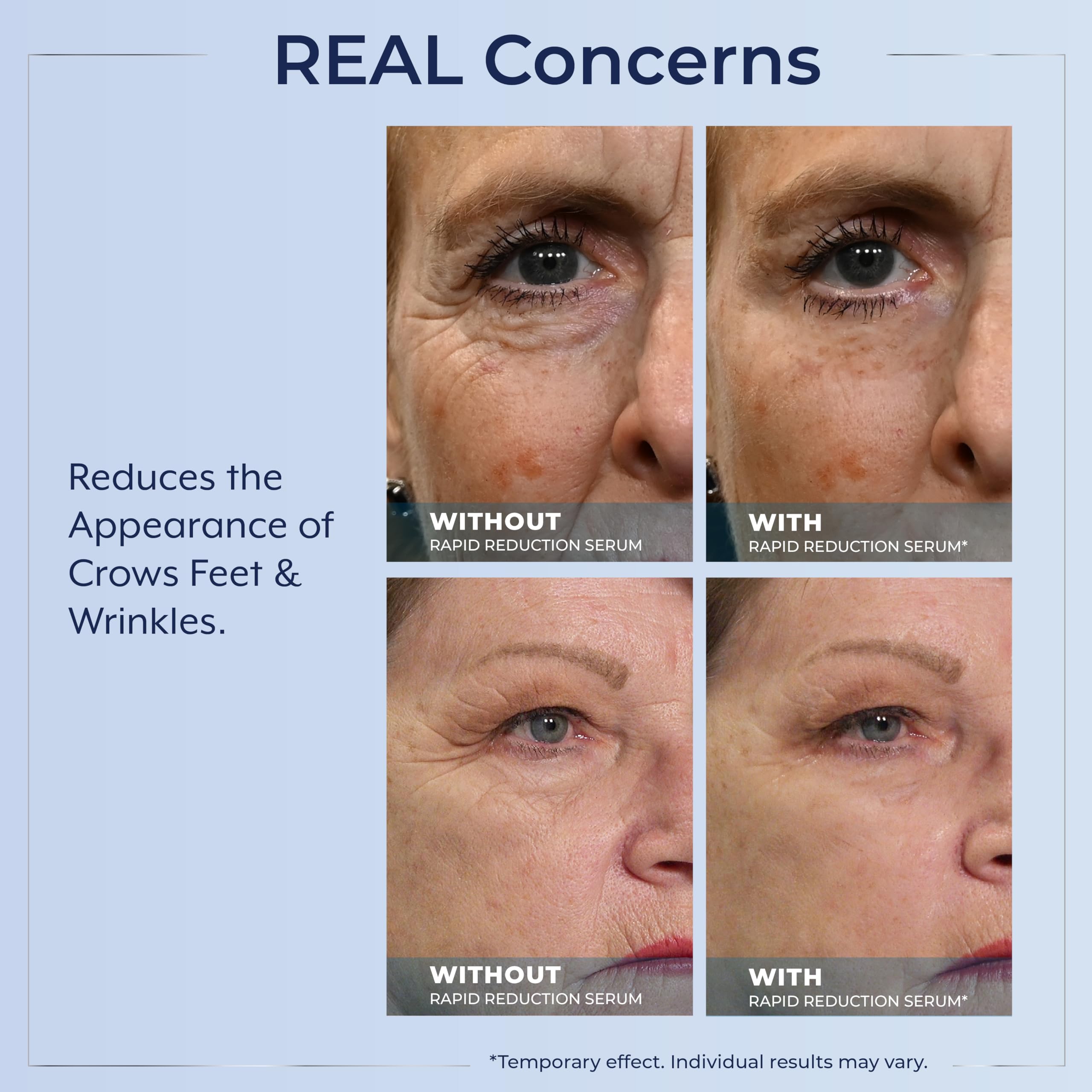 Plexaderm Rapid Reduction Eye Serum — Instant Under-Eye Tightening & Smoothing (3 Full-Size Tubes)