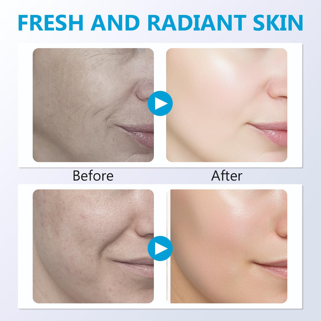 Prettypum Salmon DNA Ampoule – Microneedling Serum with Collagen, Glutathione & Hyaluronic Acid