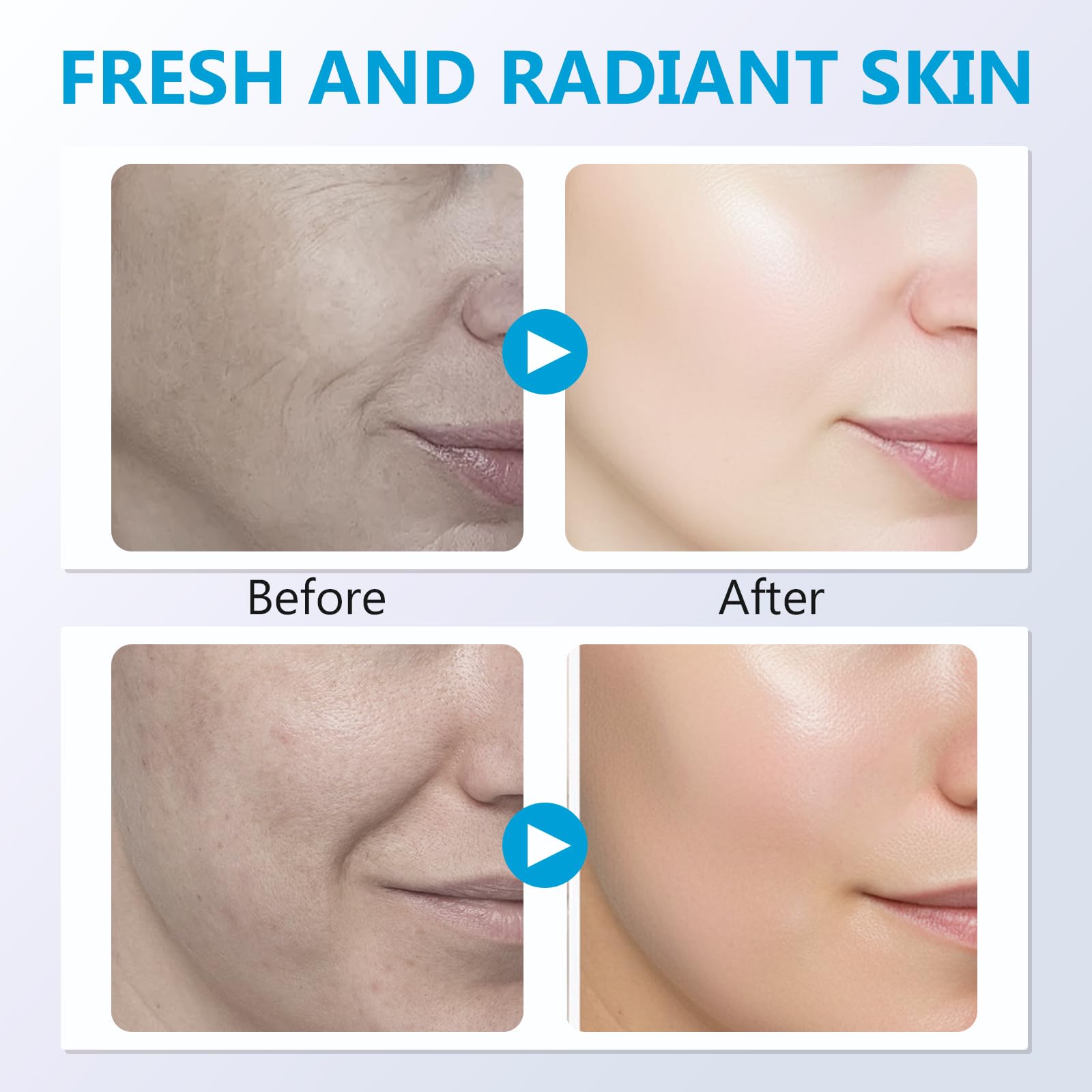Prettypum Salmon DNA Ampoule – Microneedling Serum with Collagen, Glutathione & Hyaluronic Acid