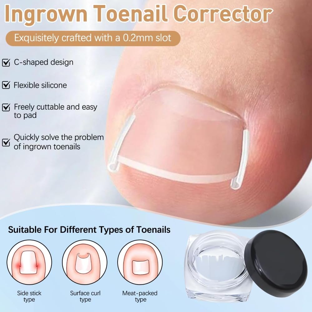 Professional Pedicure Tools Ingrown Toenail Kit – 4-Piece Set with Breathable Corrector Strips, Curved Patches, File & Lifters