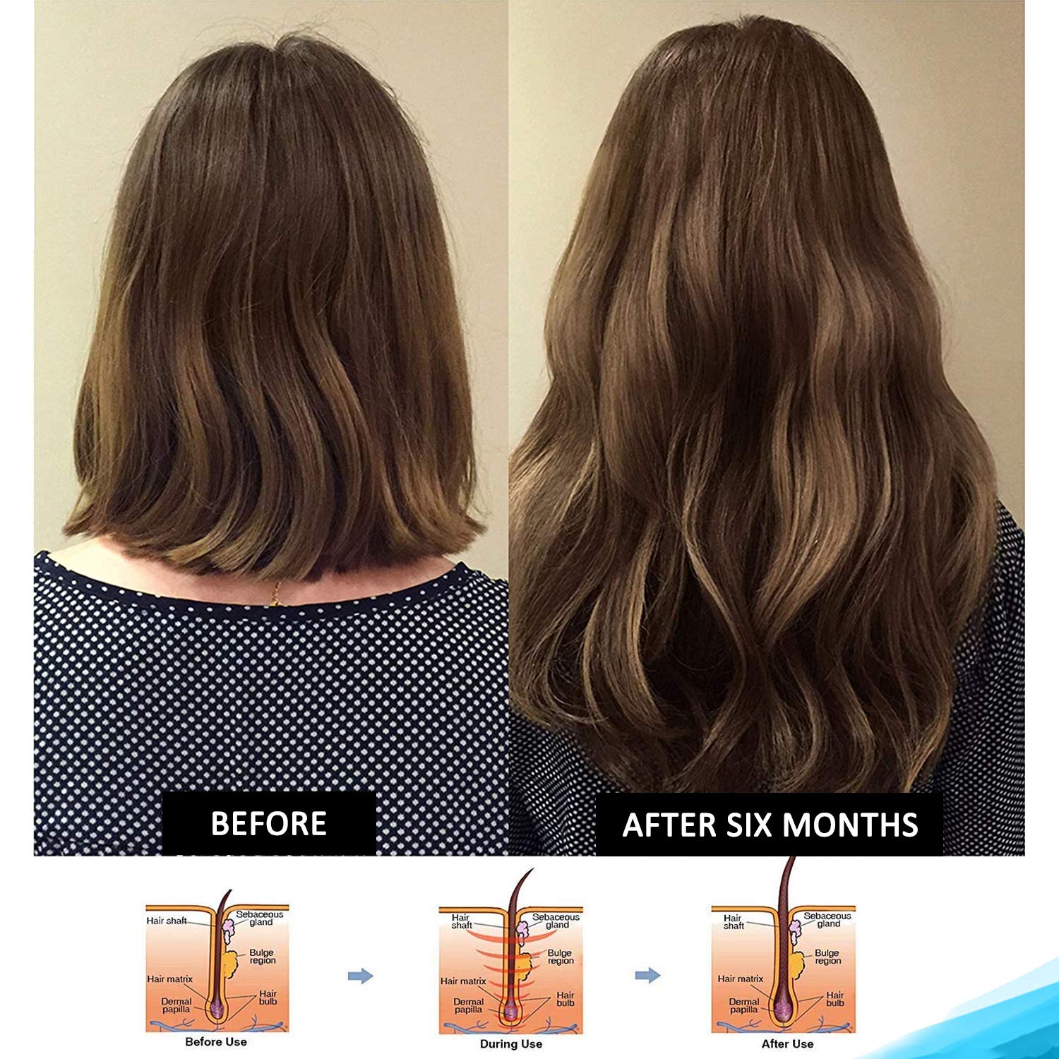 Pronexa Hairgenics Clinical Strength Hair Growth Shampoo with Biotin, Collagen & DHT Blockers – 8 fl oz