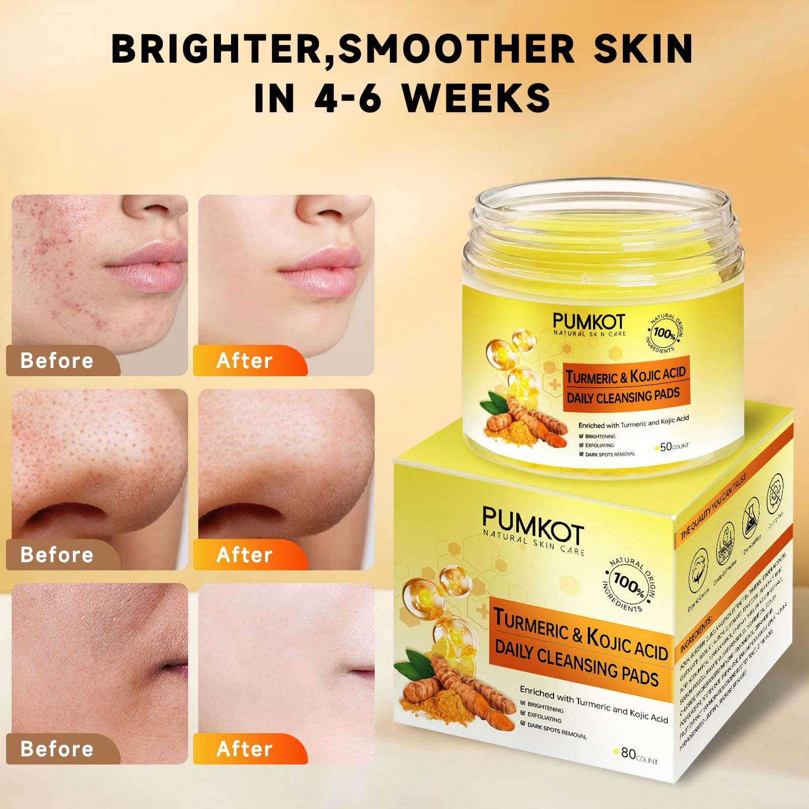 Pumkot Turmeric Kojic Acid Cleansing Pads – 80pcs Gentle Exfoliating Facial Pads