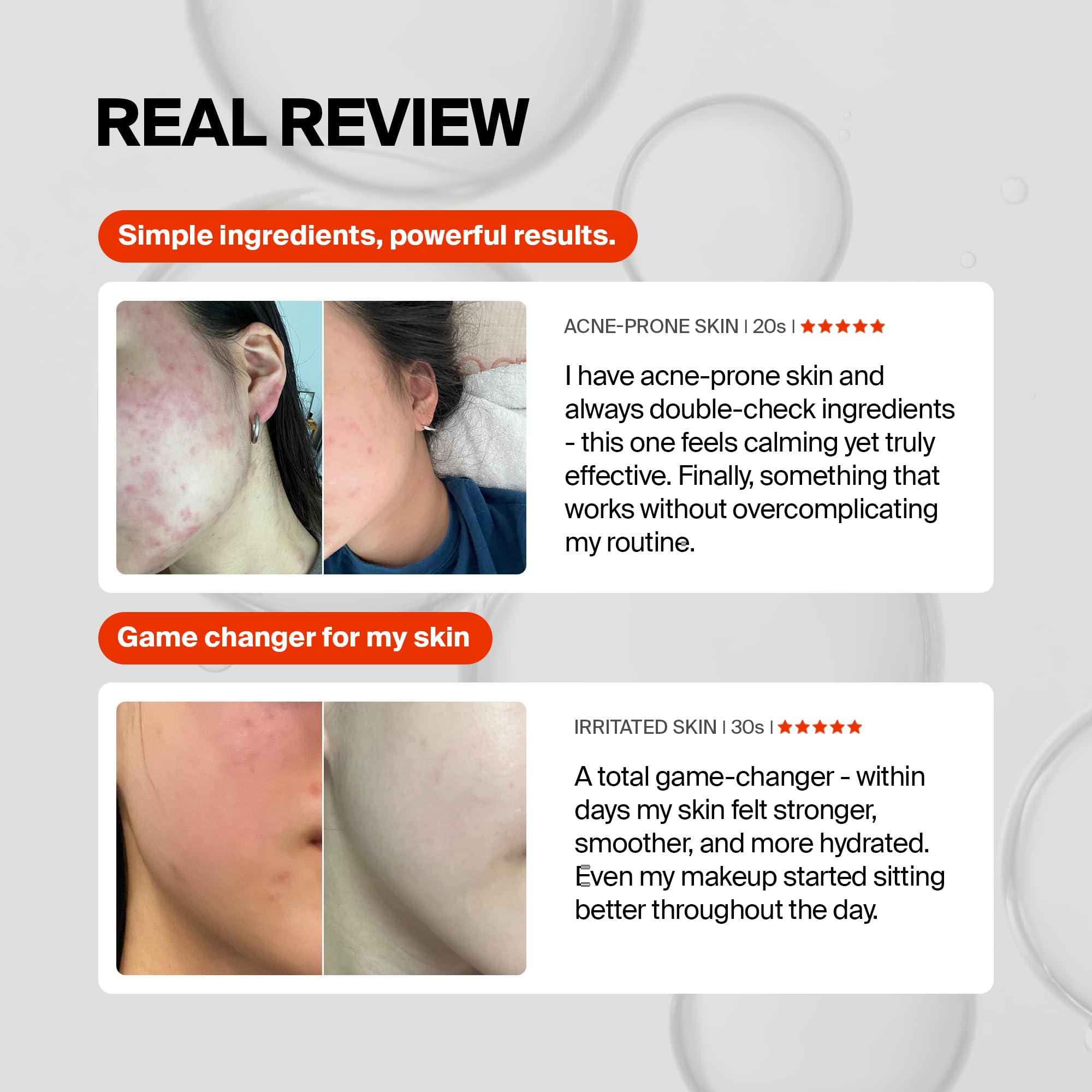 PURCELL Pixcell Biom Probiotic Essence – Restores Skin Barrier