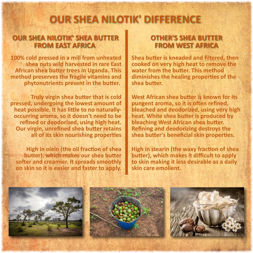 Shea Terra Organics Nilotik’ Shea Butter Lotion with Dakara Frankincense – Ultra-Rich Daily Moisturizer, 16 oz