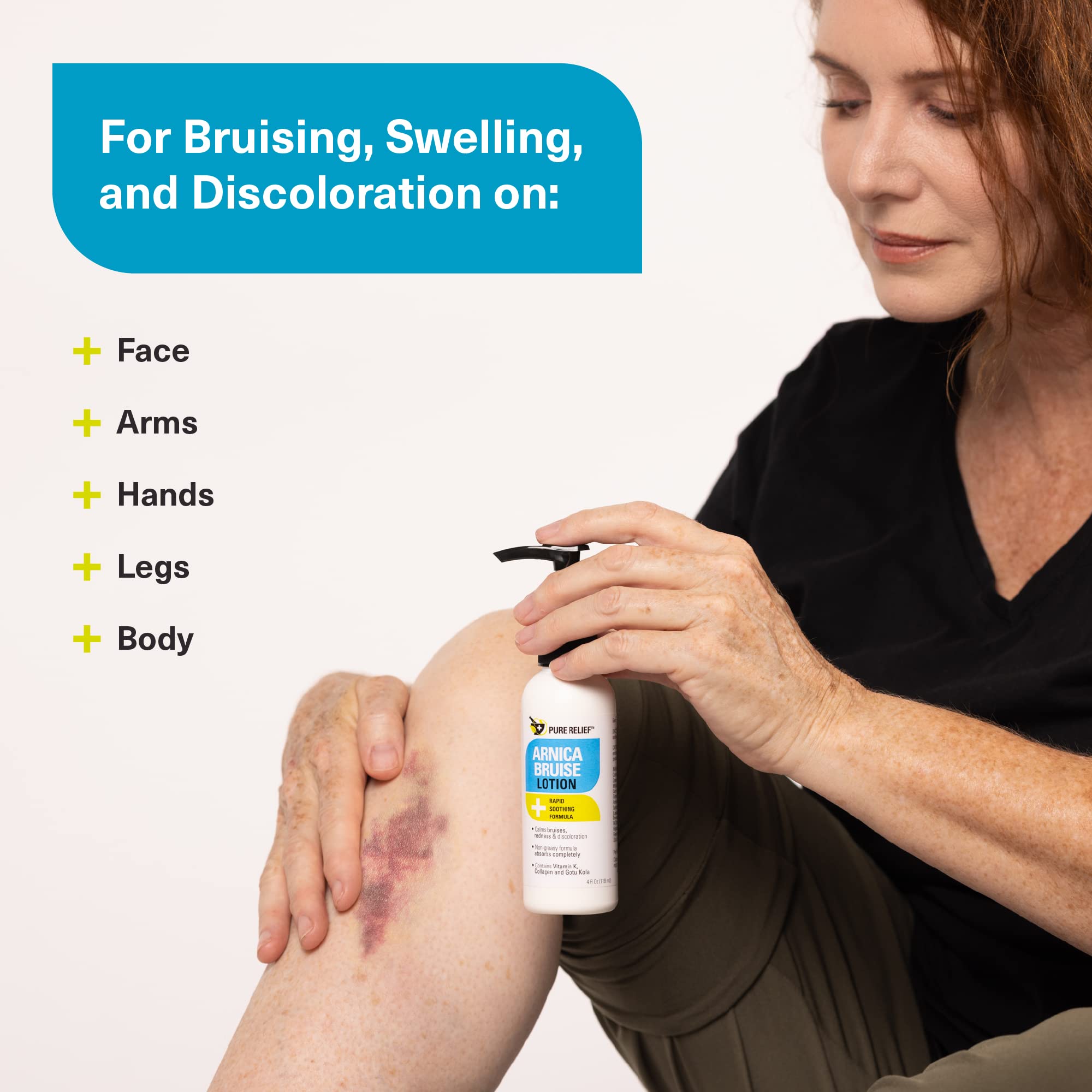 Pure Relief Arnica Cream: Extra Strength Bruise & Swelling Relief with Vitamin K, Collagen – 4 oz