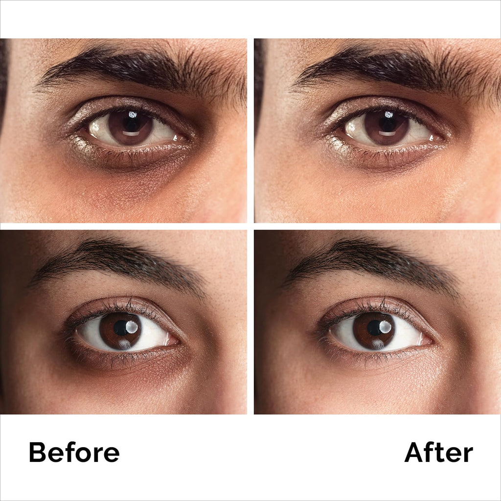 PURE RESEARCH Caffeine Eye Cream – Anti-Aging, Dark Circles & Puffiness (1.7 oz)